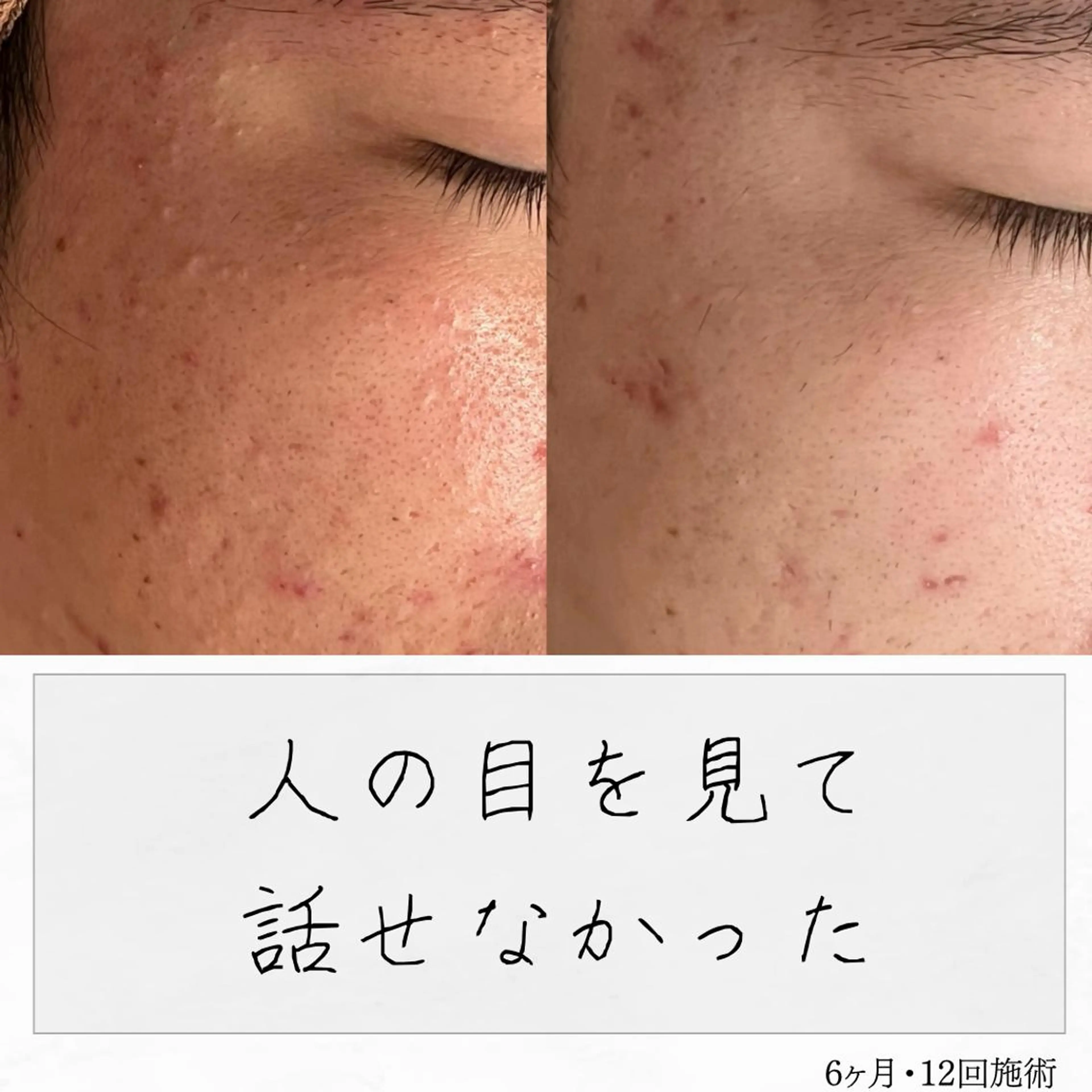 ニキビ経験者が施術 する専門サロン🌻のエステ・リラクイメージ