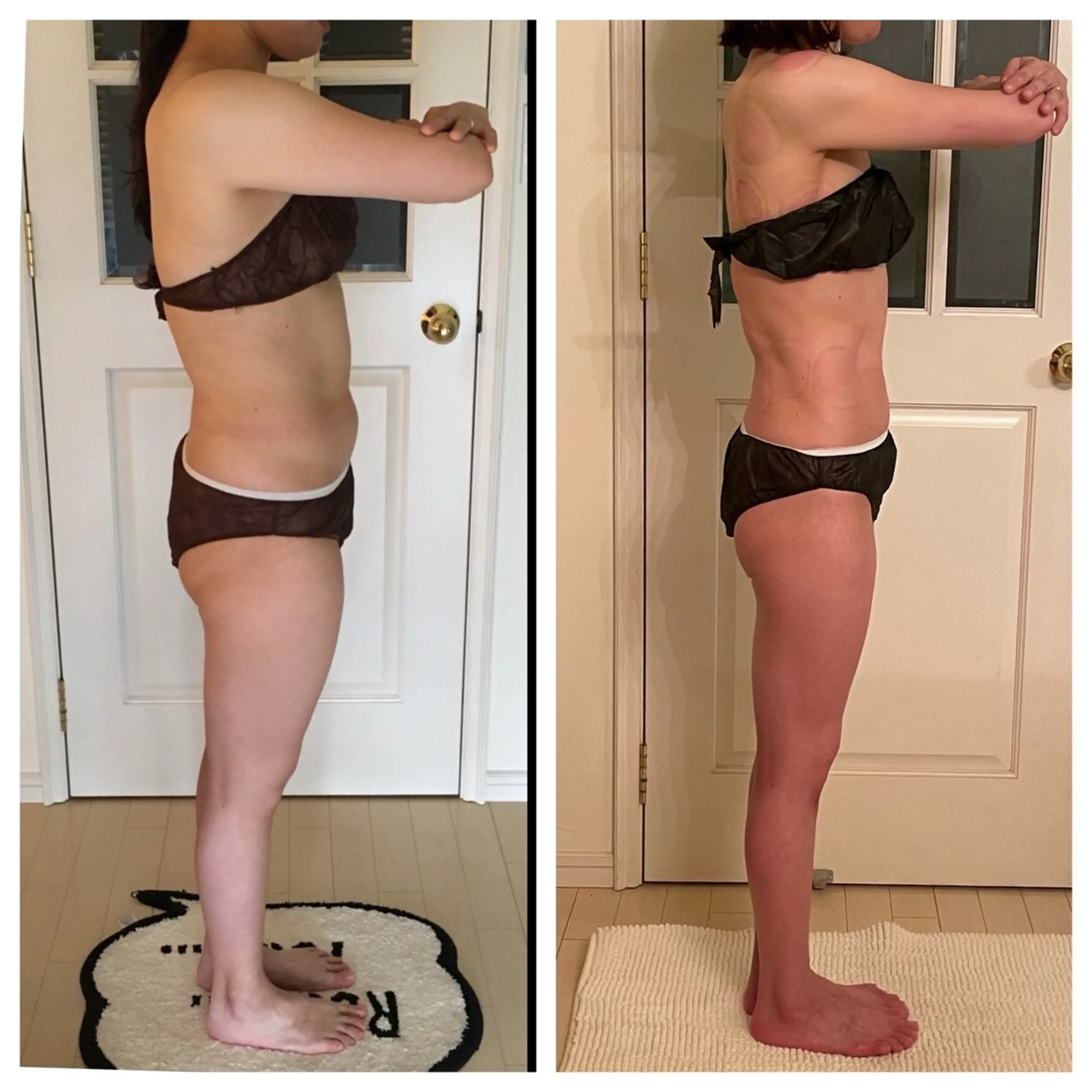 エステ リラク 超ド級痩身/ 肩こり撃退のエステ・リラクイメージ