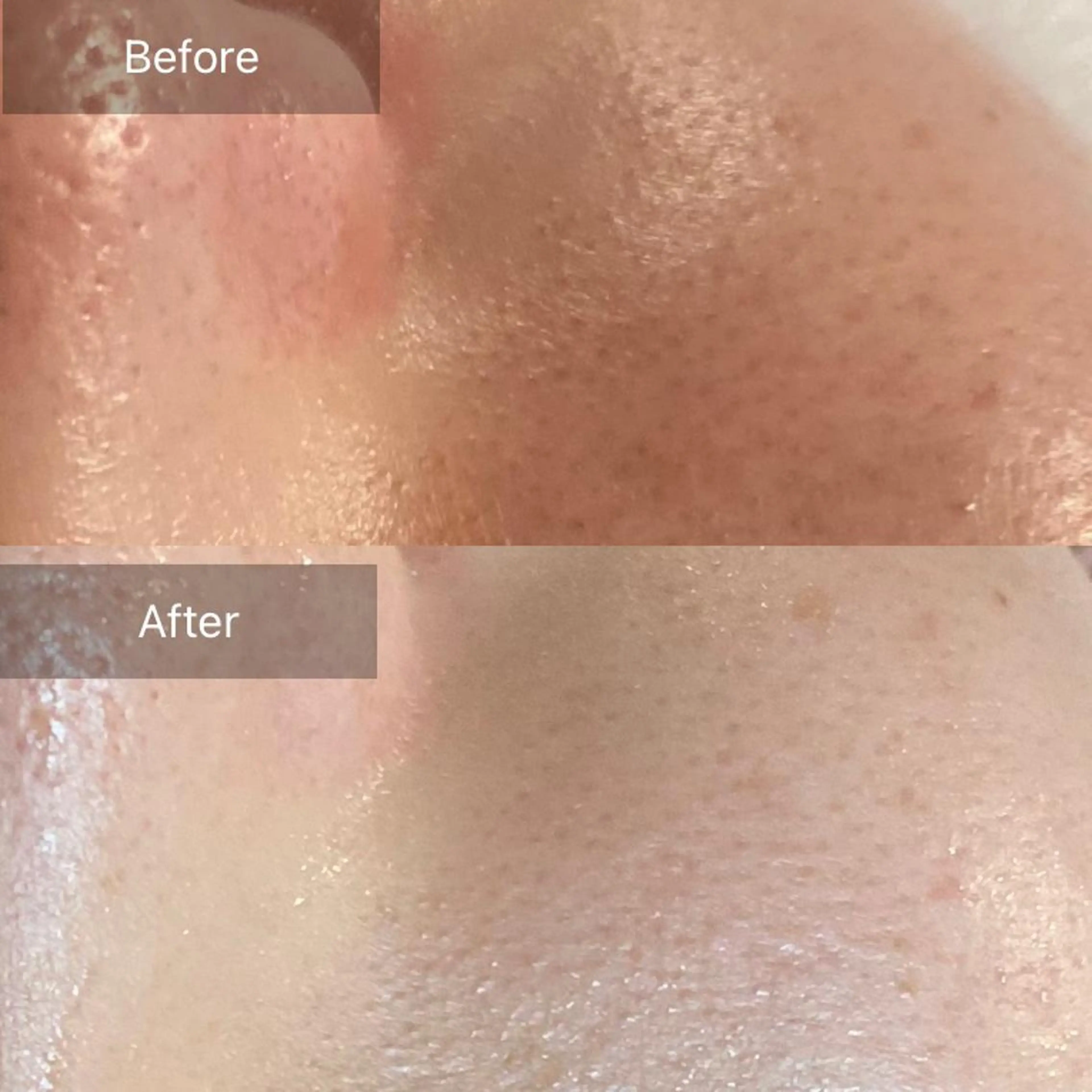 毛穴から始める肌メン テマンダリンオレンジのエステ・リラクイメージ