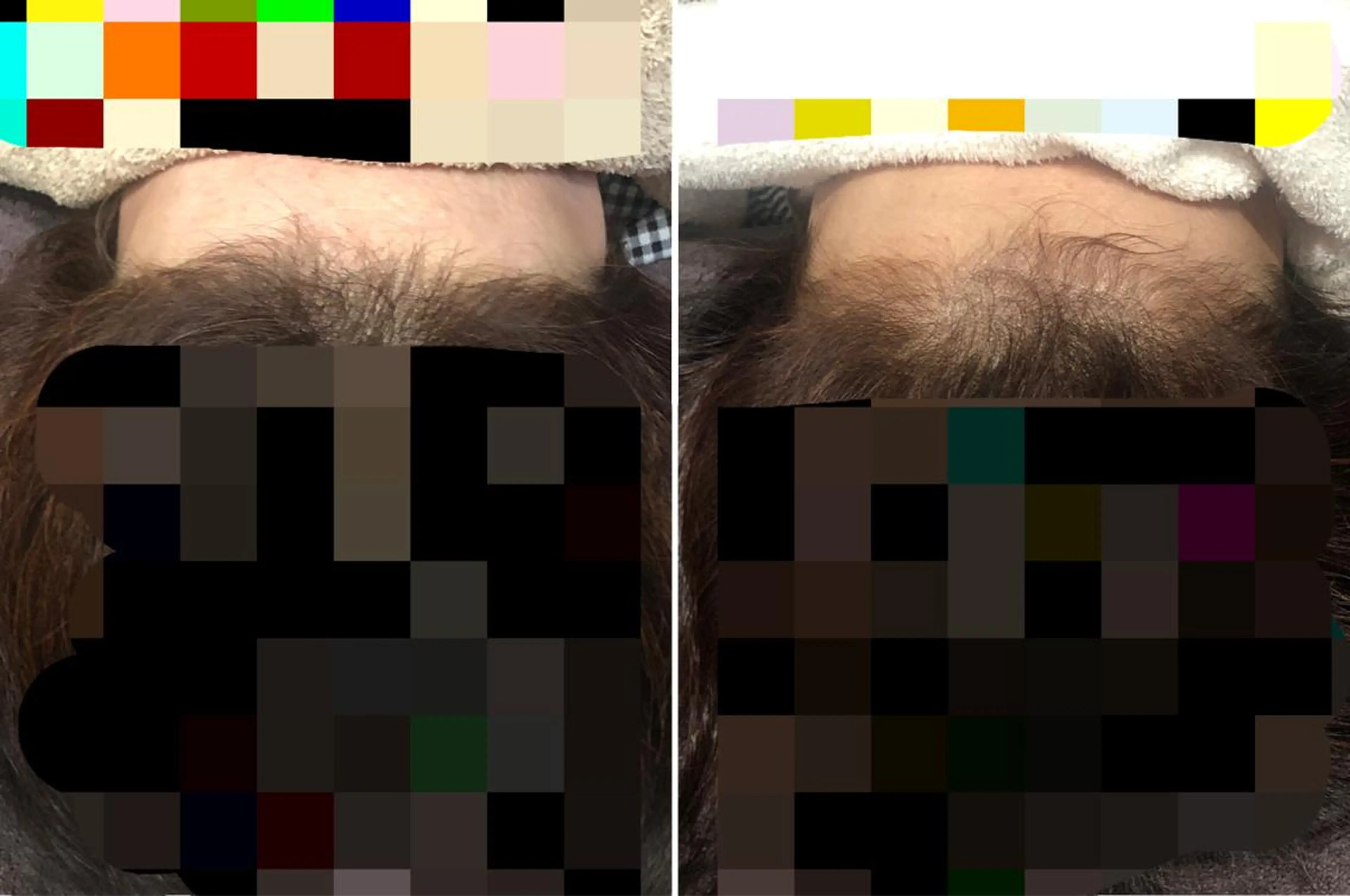 ミディアム その他 セントラル鍼灸院 Re:laxyのヘアスタイル