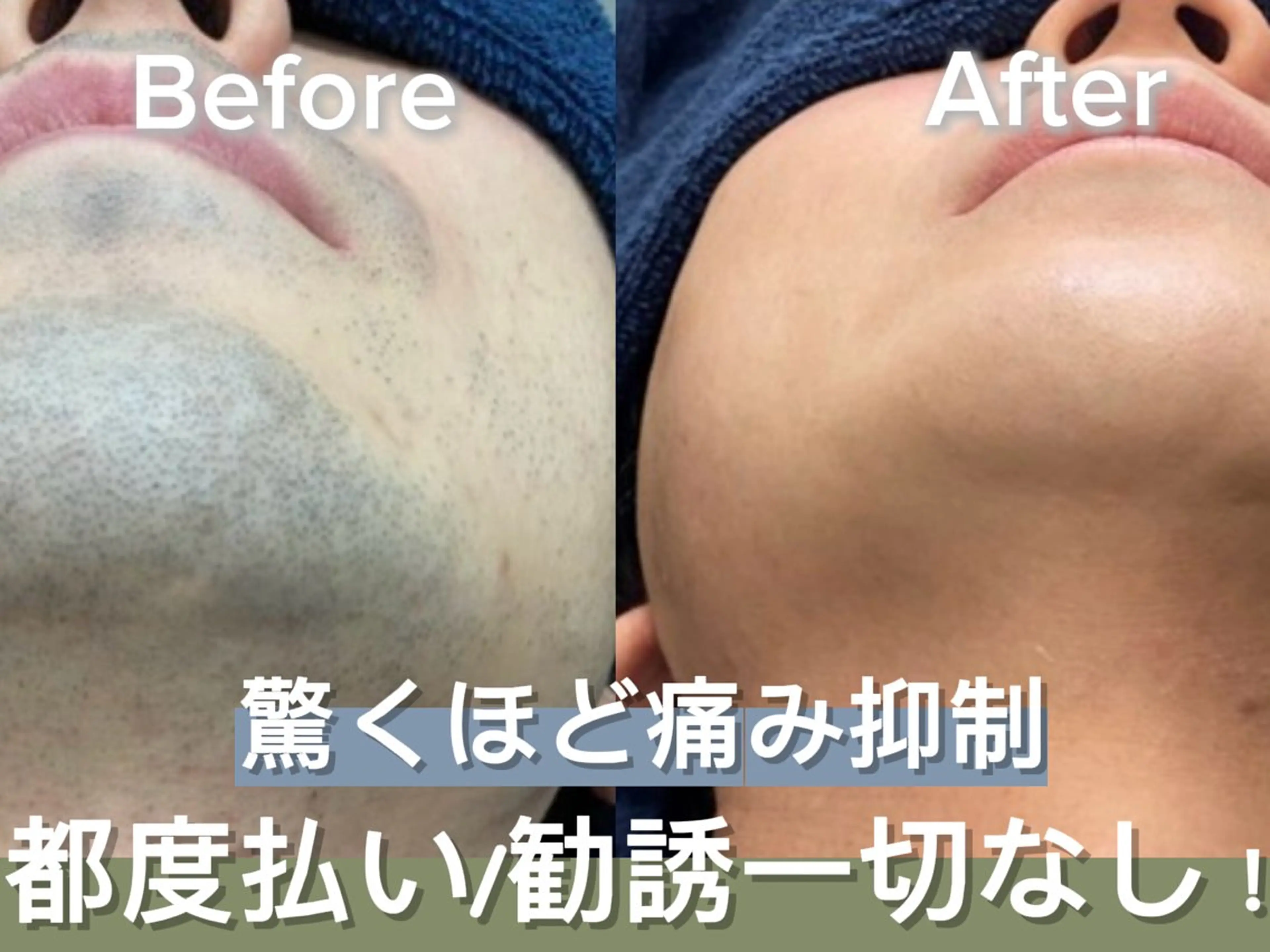 メンズ 脱毛サロンat ikaw下北沢所属・at ikawのエステ・リラクイメージ