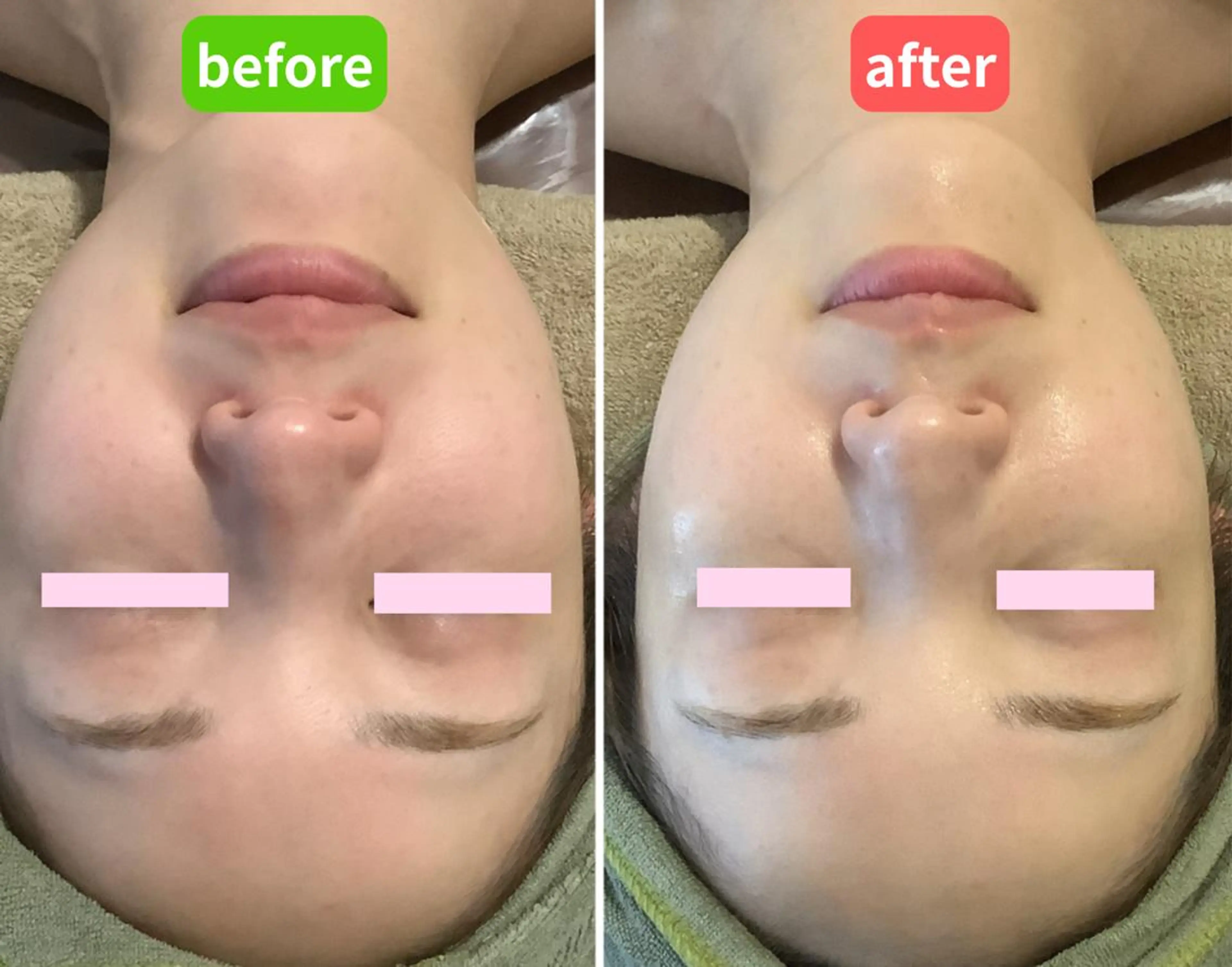 エステ 毛穴＆ピーリング肌育 サロンのエステ・リラクイメージ