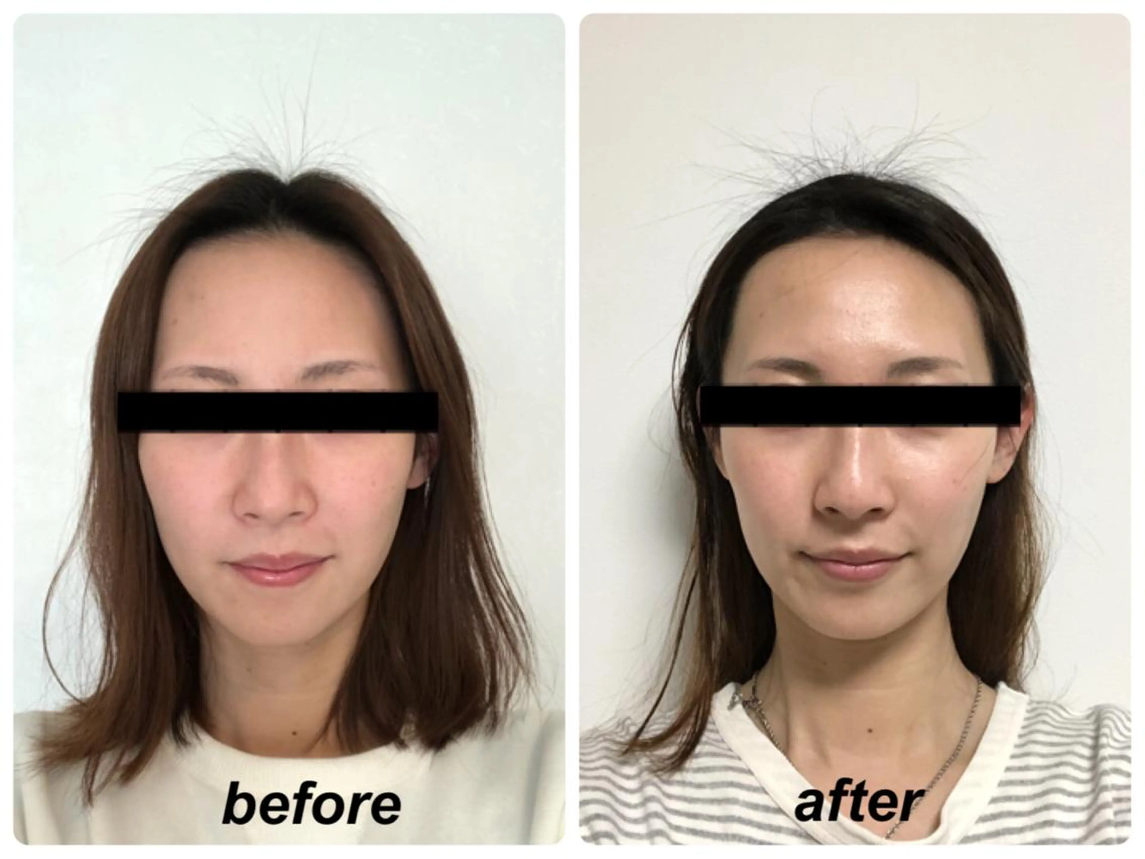 Radiance H.Oのエステ・リラクイメージ