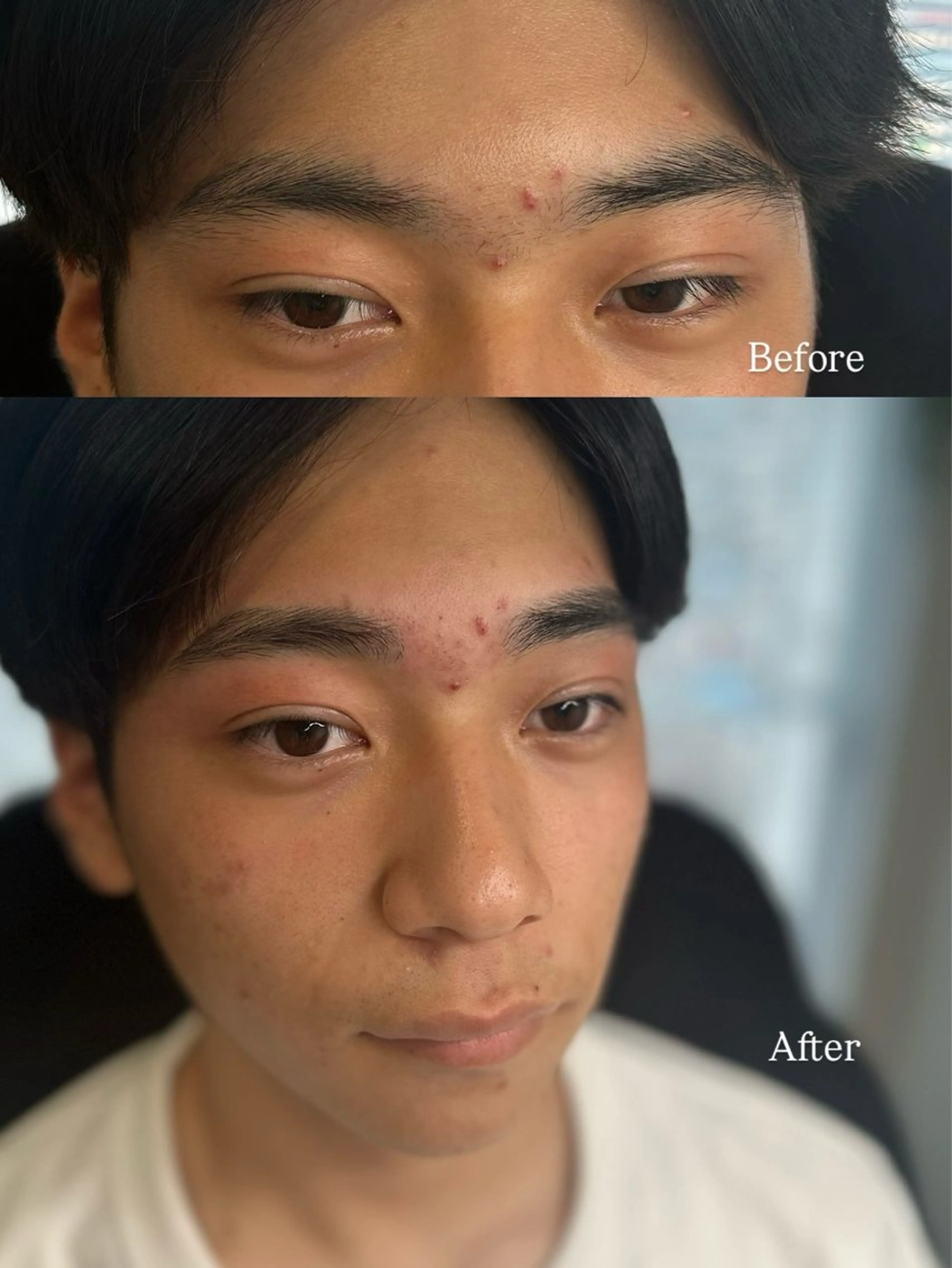 メンズ アイブロウ 頭皮・薄毛改善サロン ｜眉毛｜痩身のエステ・リラクイメージ