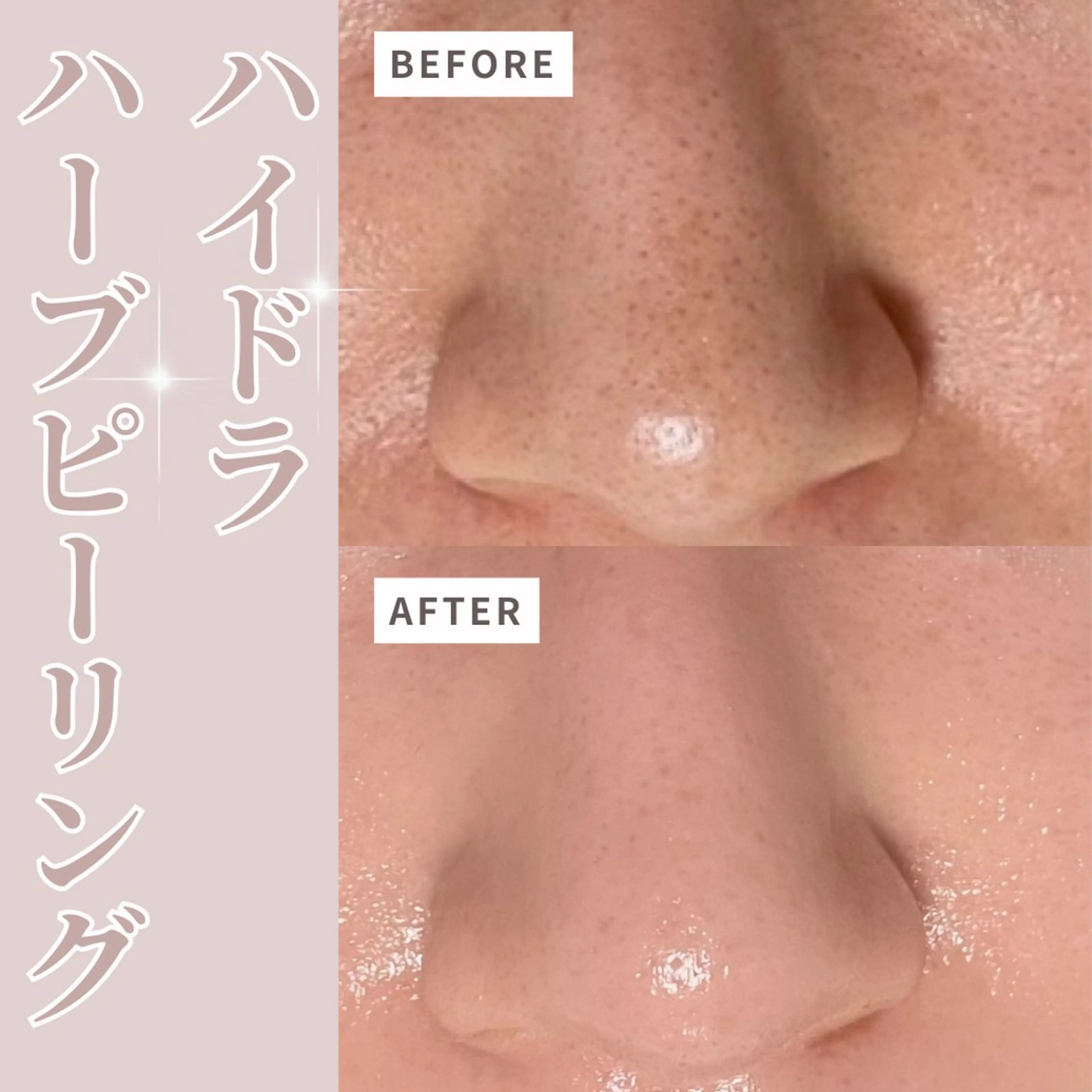 エステ プライベートサロン Belle（ベル）のその他イメージ