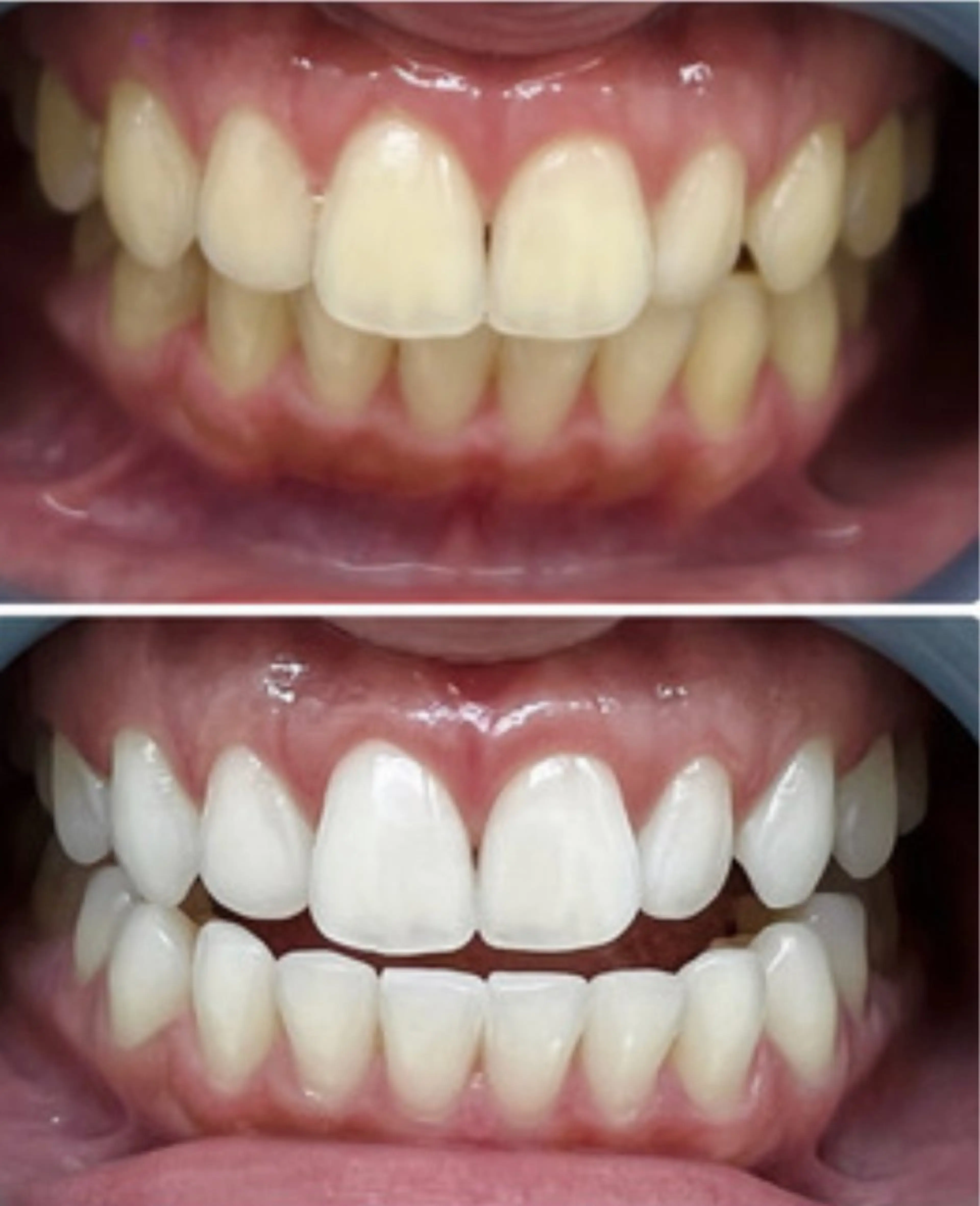 その他 セルフホワイトニングサロンMW 新越谷店所属・セルフホワイトニング サロンMW新越谷店のその他イメージ