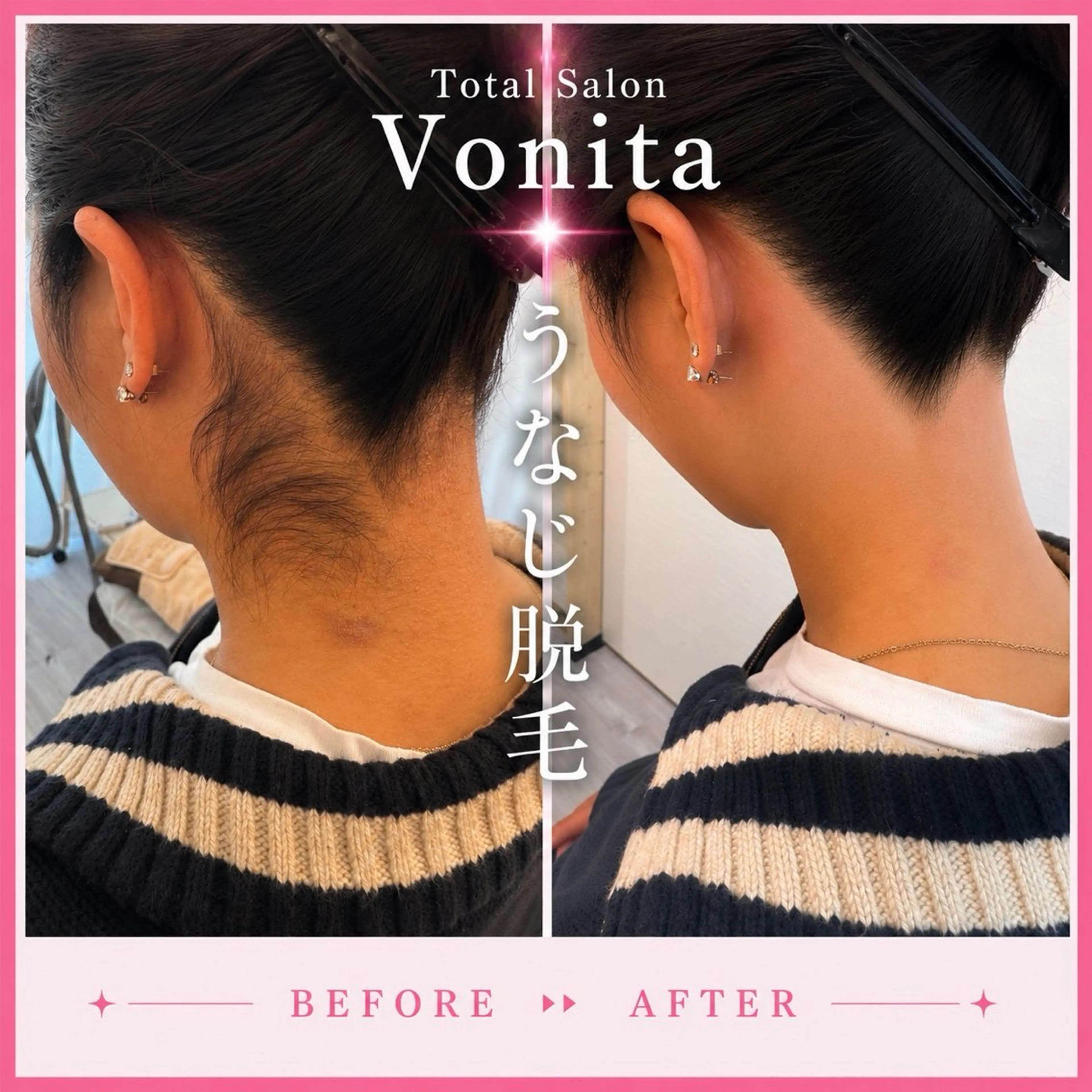 脱毛 Vonita Mikieのエステ・リラクイメージ