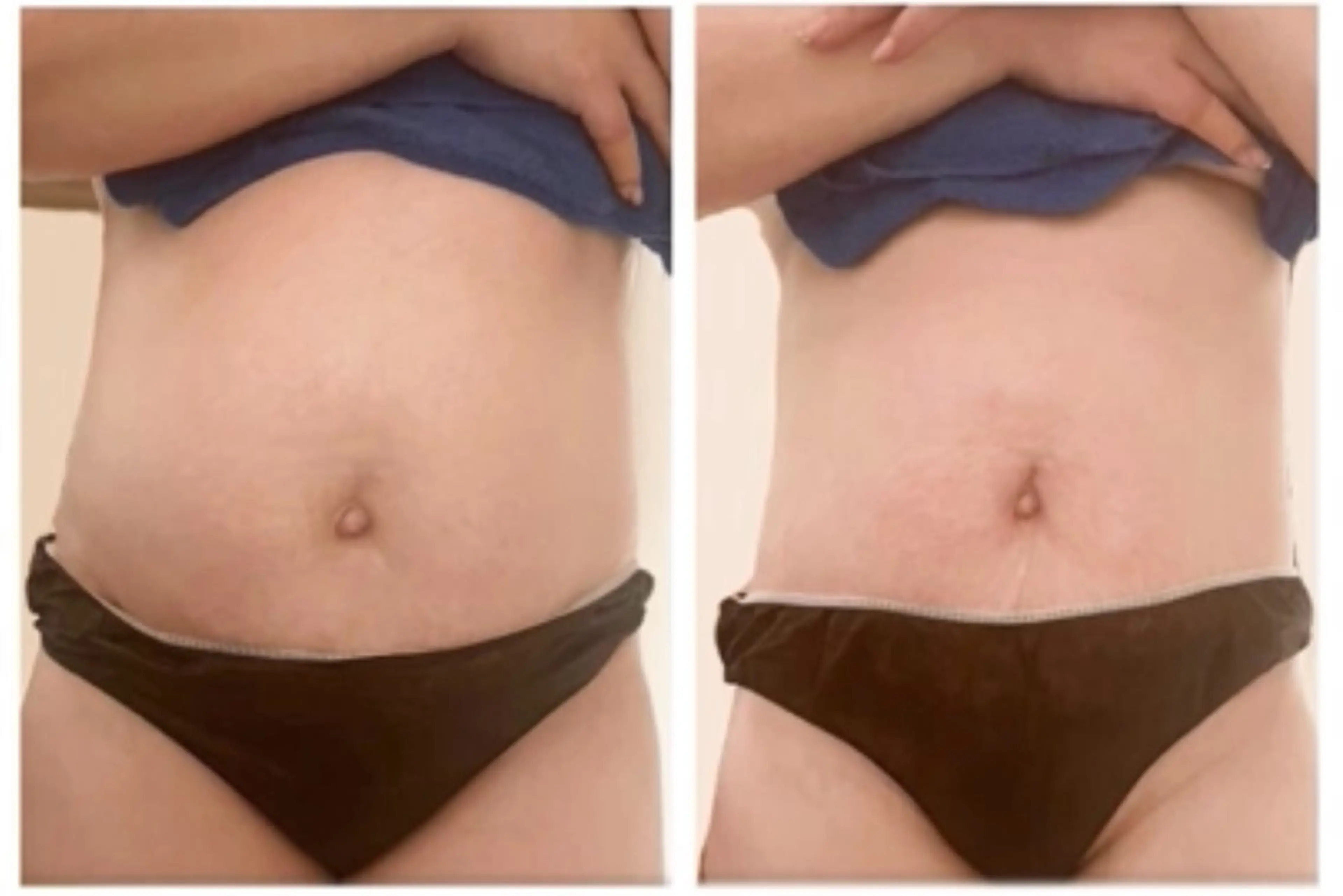 痩身120分コース本格技術【選べる部位120分痩身】の写真