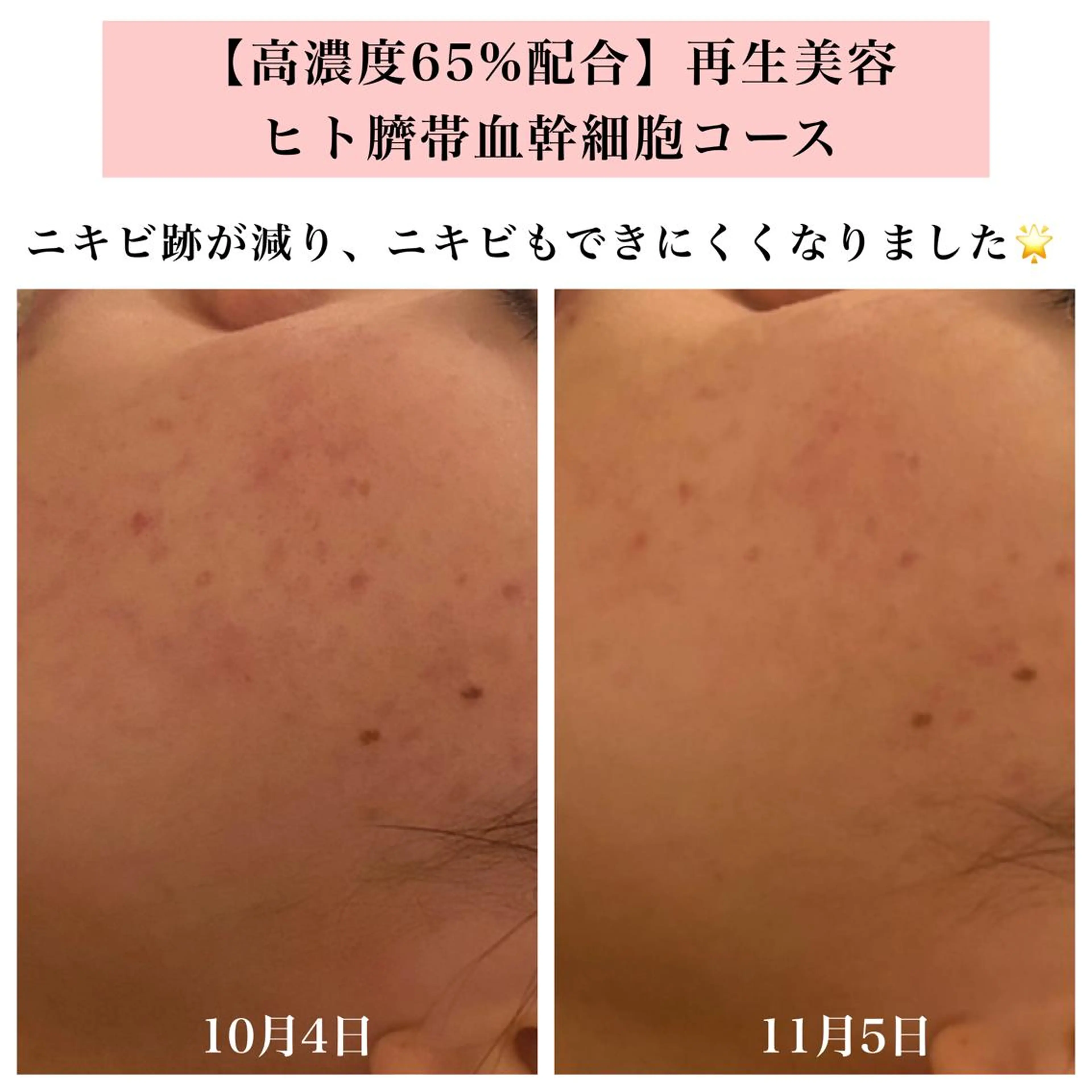 エステ リラク Bellesthe （ベルエステ）のエステ・リラクイメージ