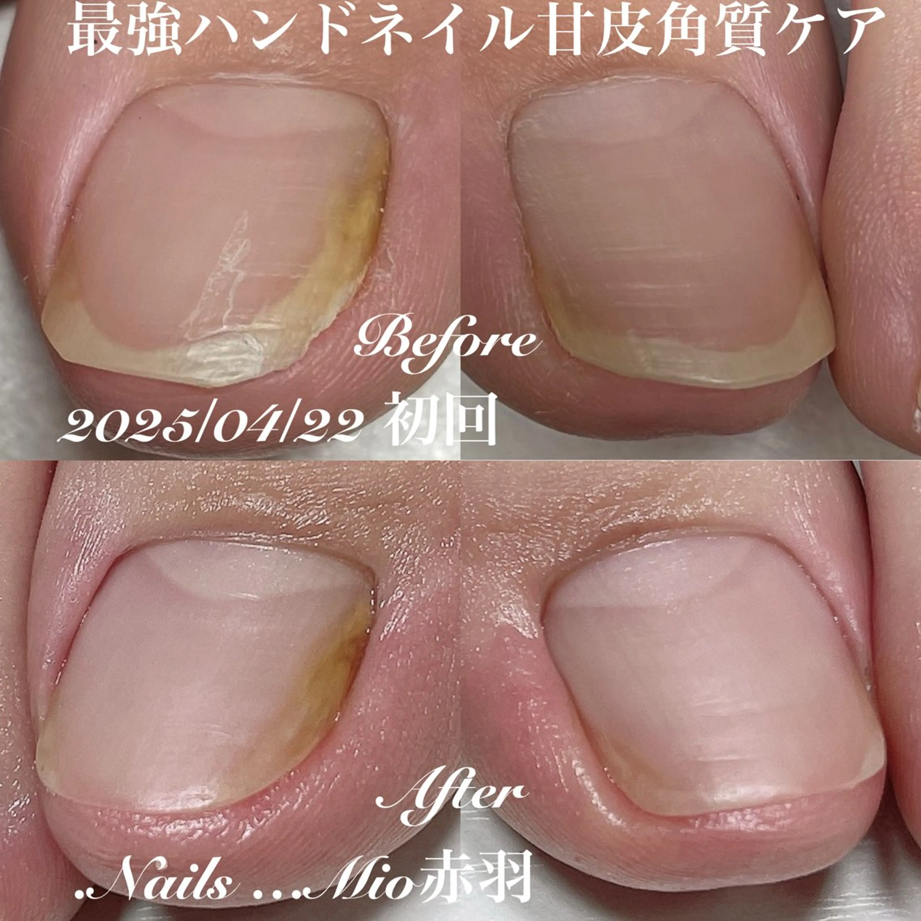 ネイル フットネイル 赤色 .Nails Mio 赤羽西ネイルサロンのネイルデザイン