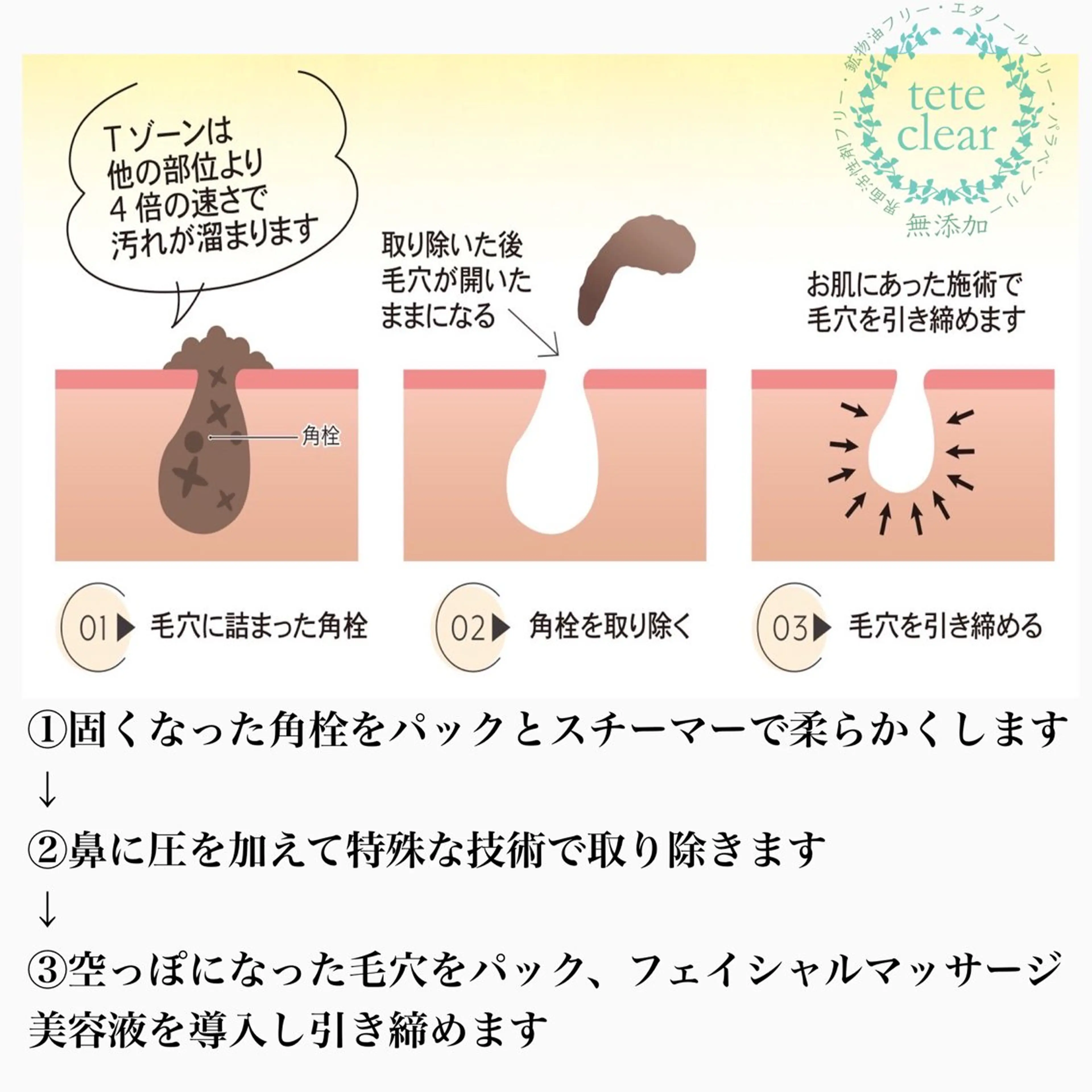 【しみ毛穴専門店】beautysalon Ankh所属・しみ毛穴専門店 Ankh 平田のエステ・リラクイメージ