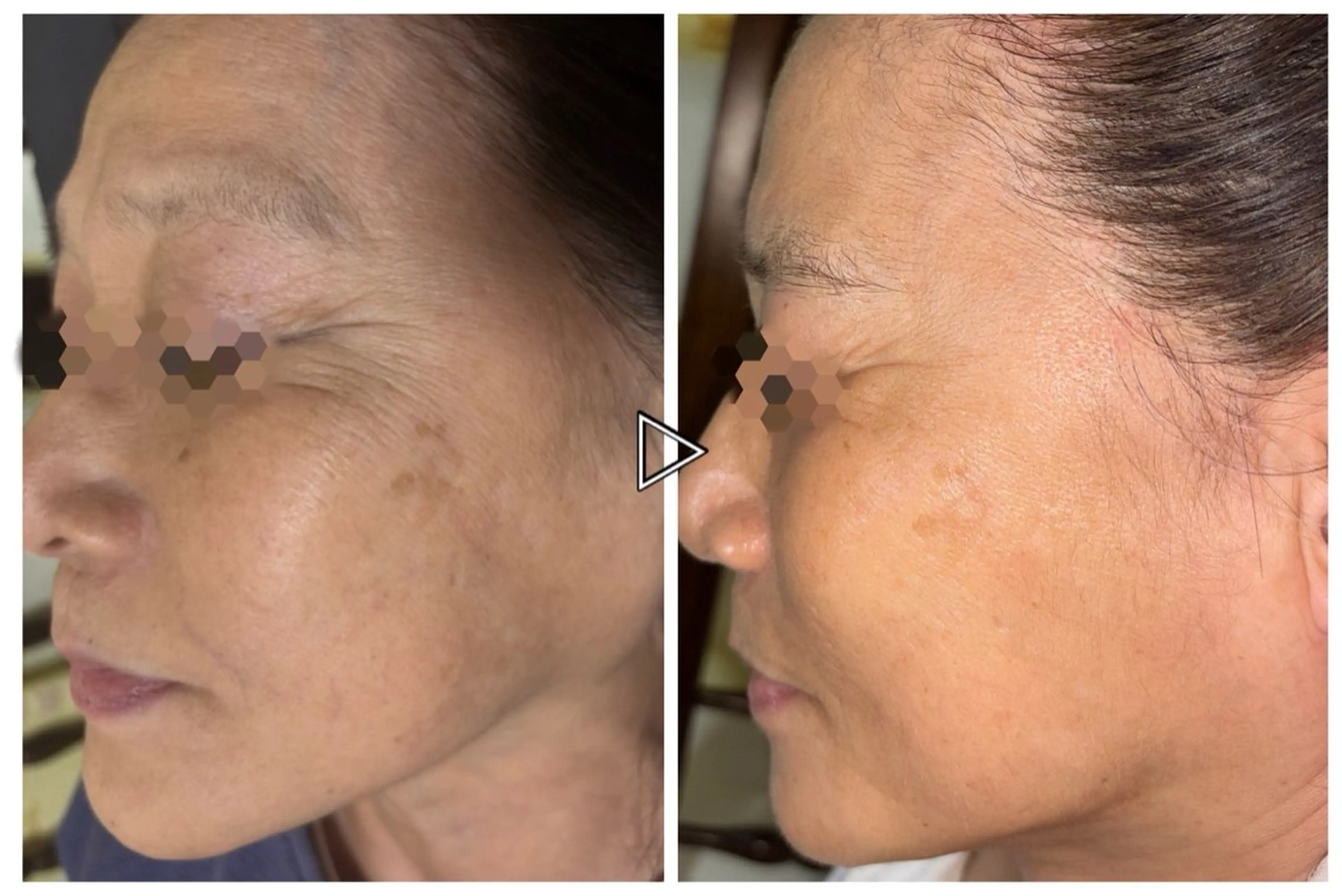 エステ monselvi/モンセルヴィ所属・monselvi 上前津エステのエステ・リラクイメージ