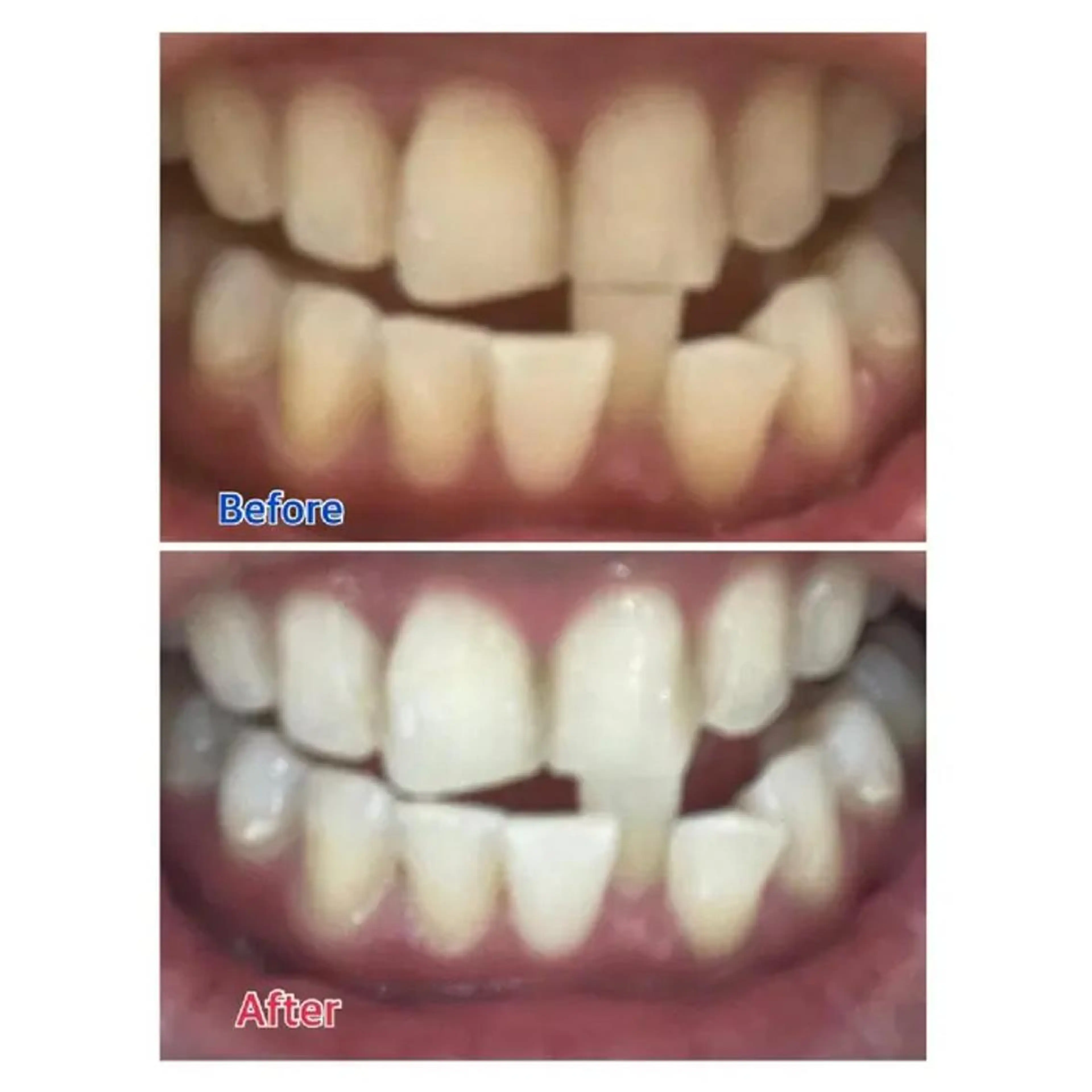 M渋谷 ホワイトニングのエステ・リラクイメージ