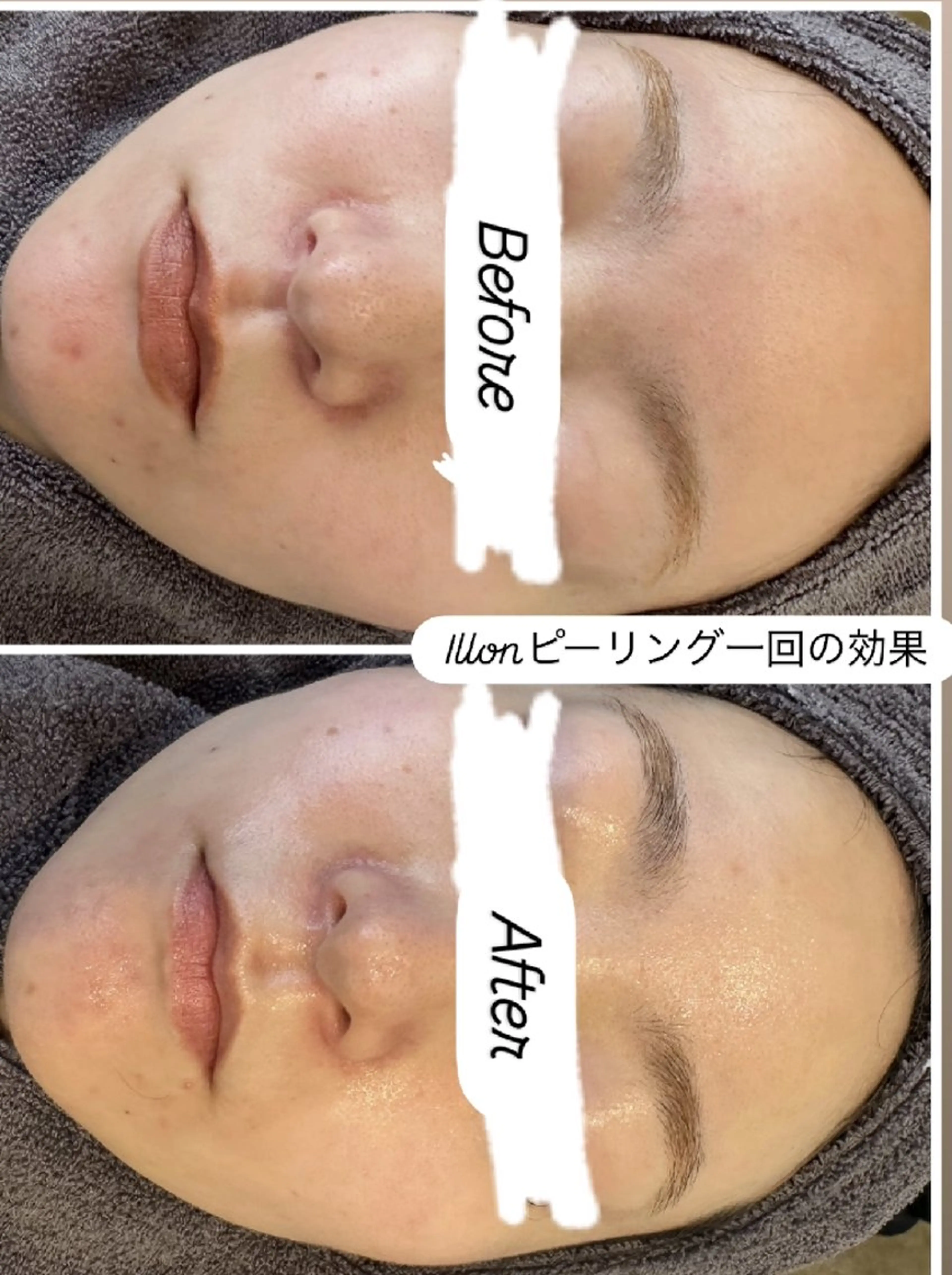 エステ 看護師 桐山 まどかのエステ・リラクイメージ