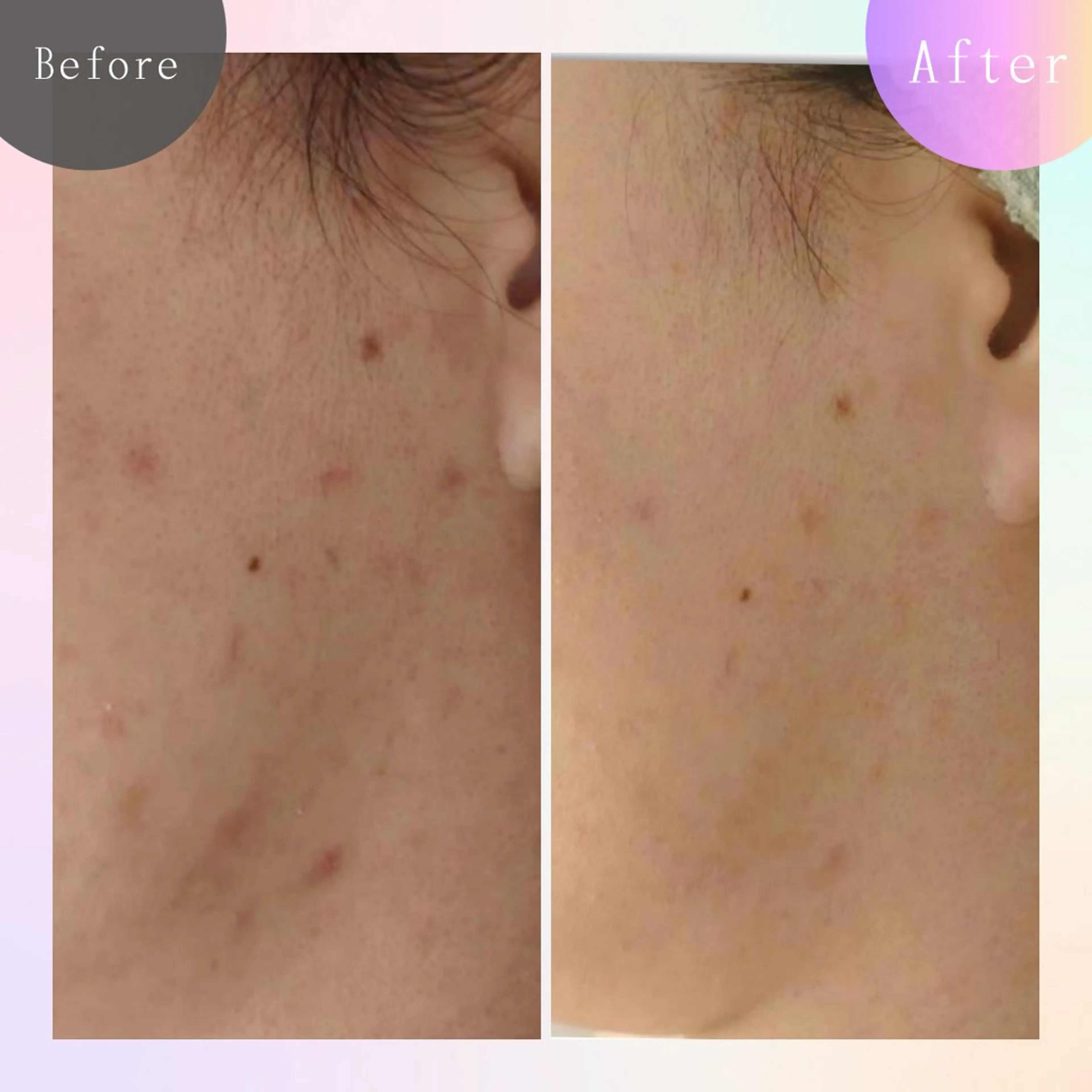 毛穴改善サロン d'Alba大阪住吉のエステ・リラクイメージ