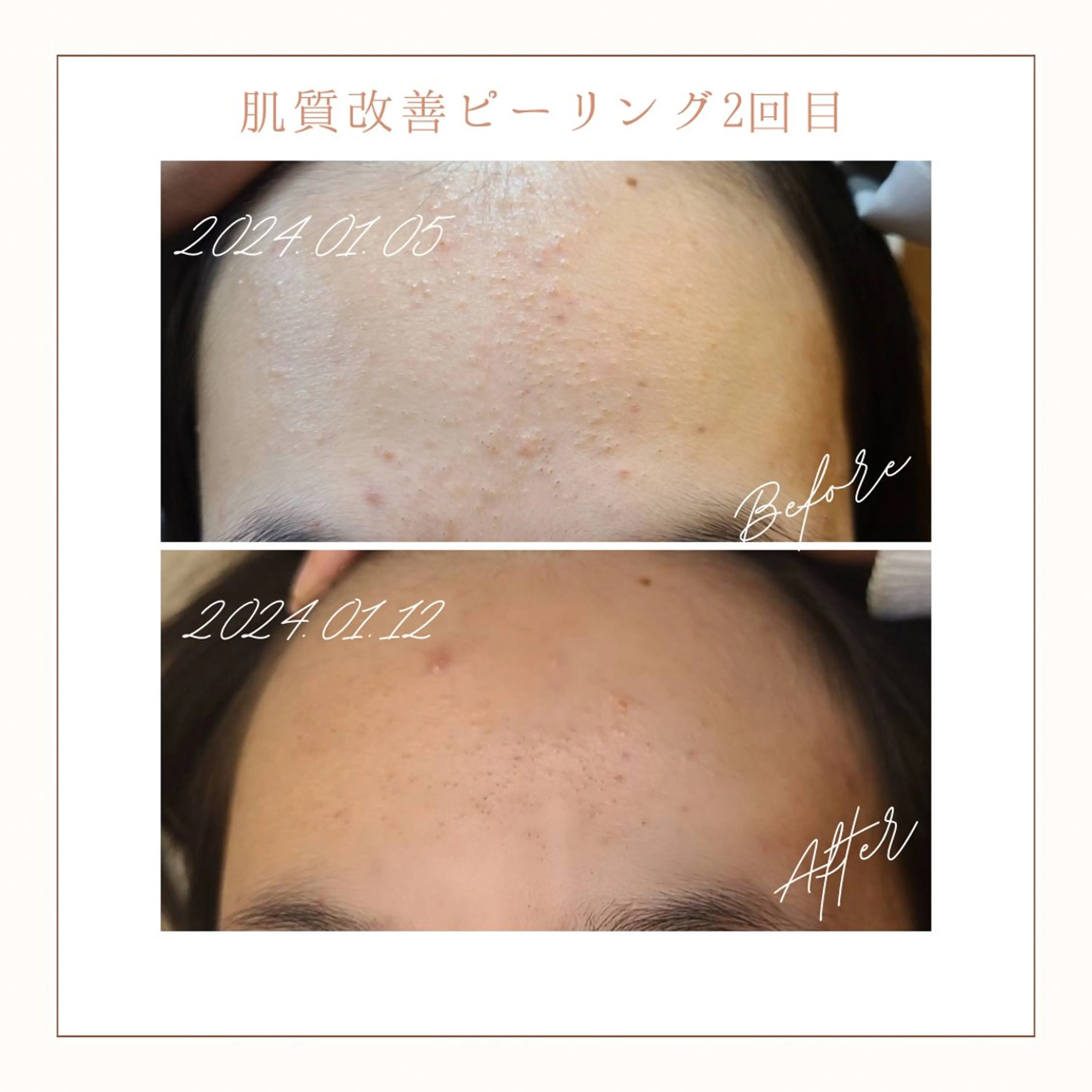 エステ リラク 小顔×肌質改善サロン soin〔ソワン〕のエステ・リラクイメージ