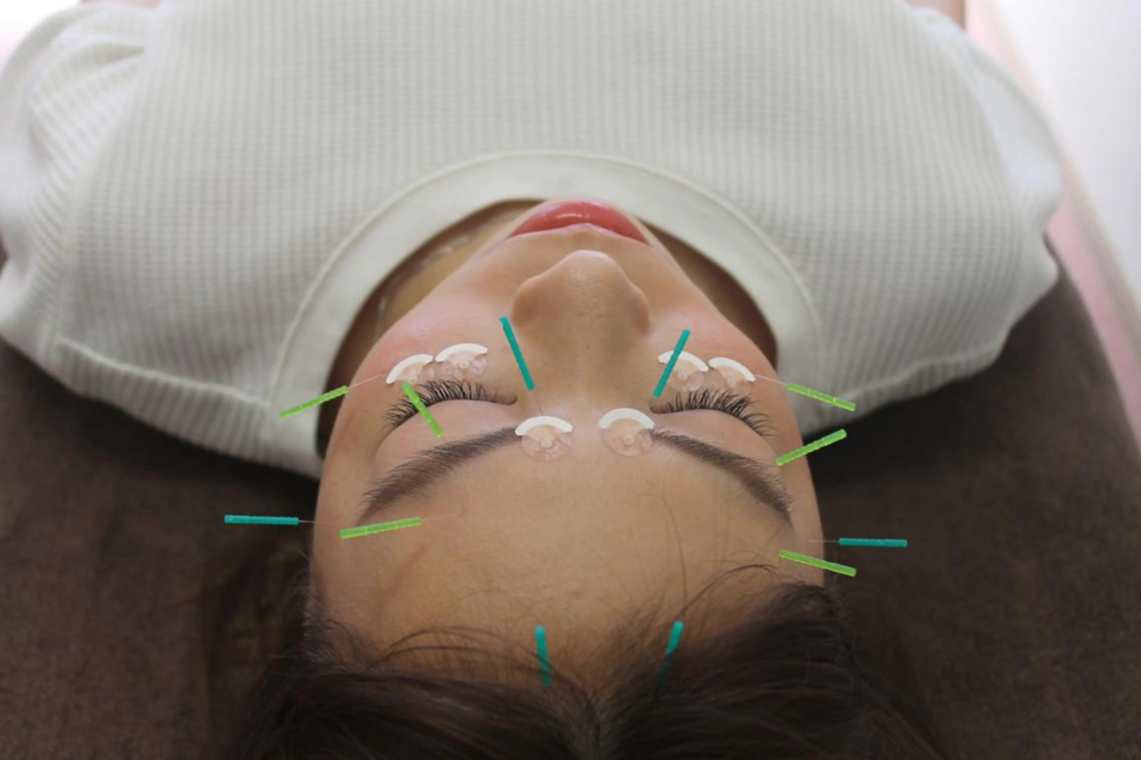 エステ 同心整骨院 美容鍼・整体・小顔のエステ・リラクイメージ