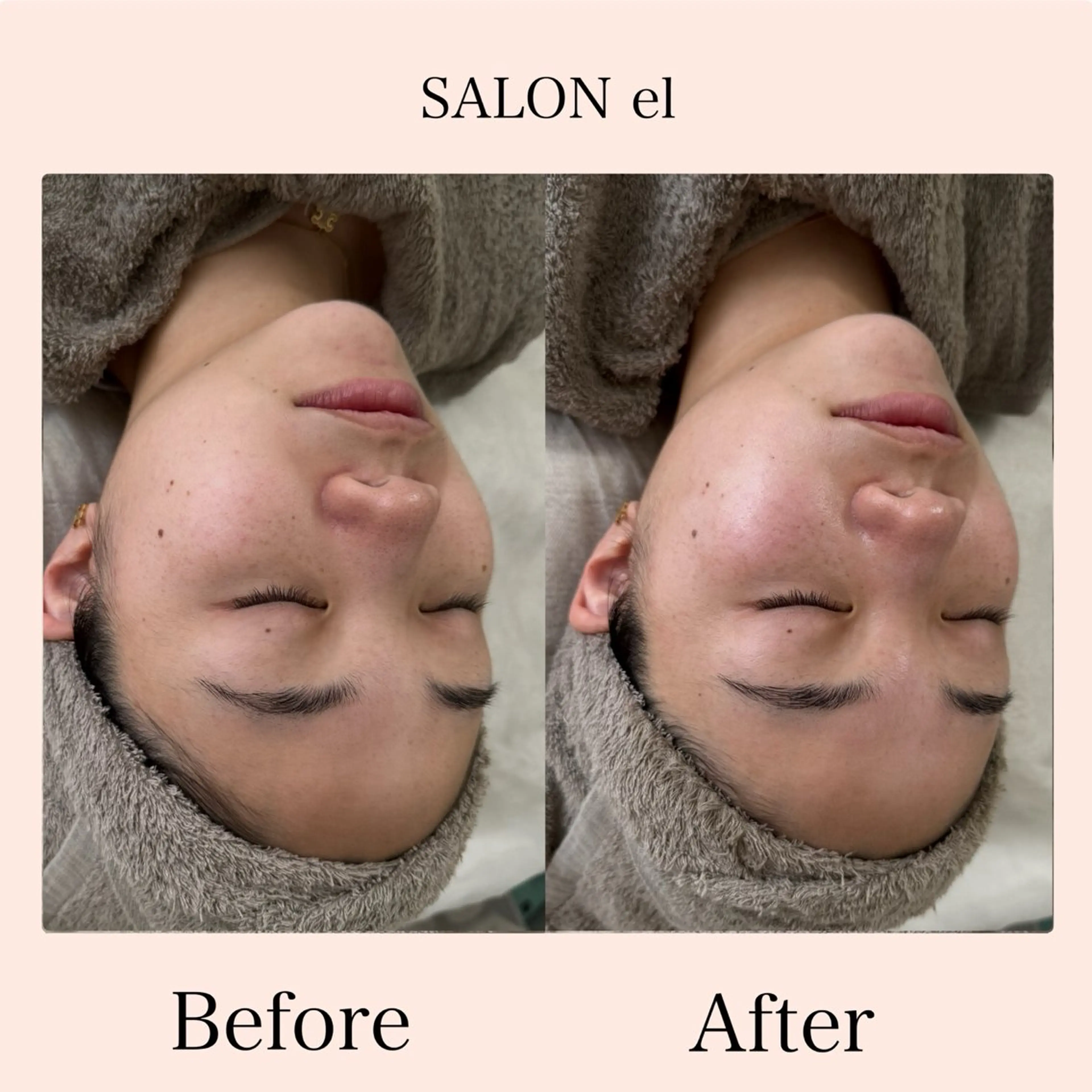 エステ SALON el KARINのエステ・リラクイメージ