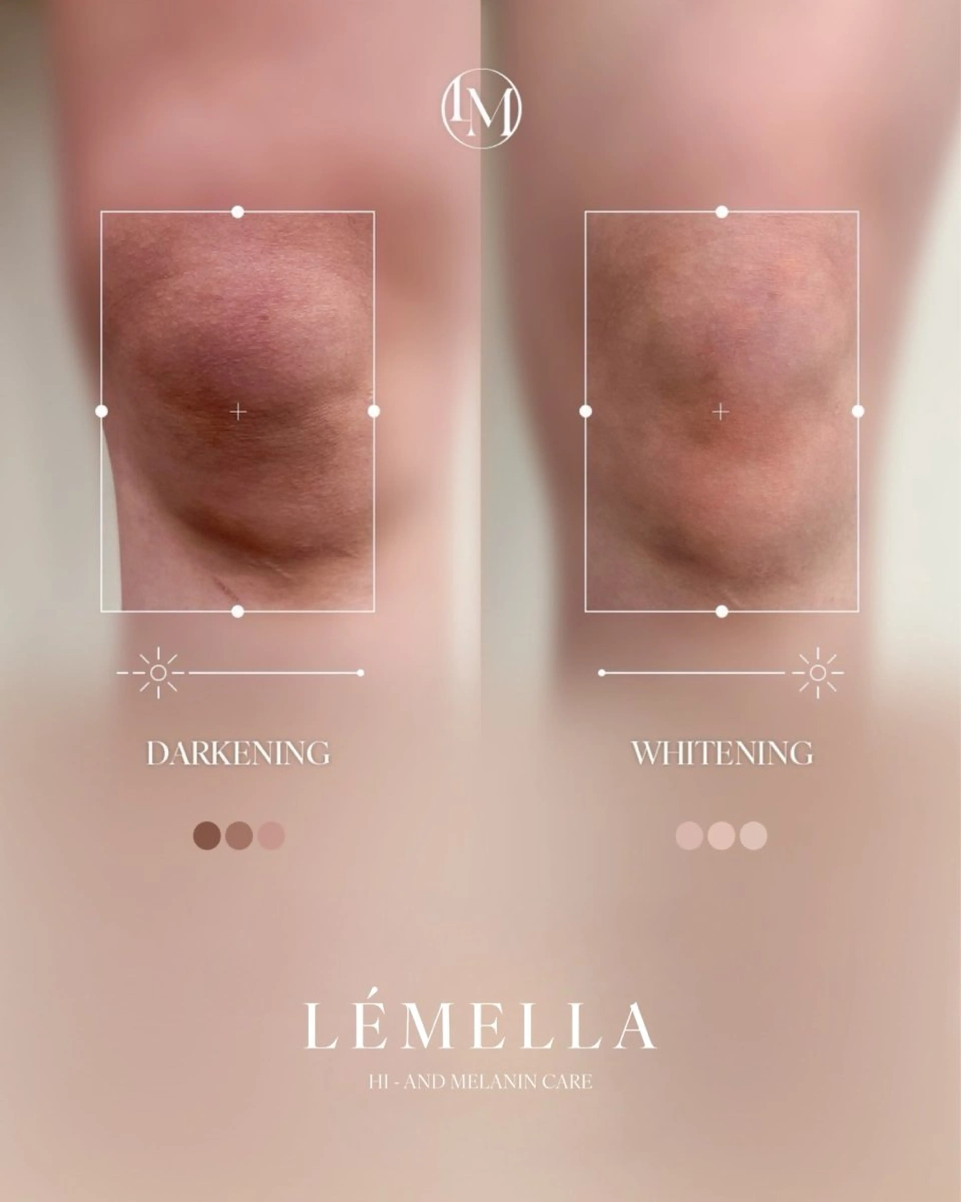 \韓国シェアNO.1/話題のLÉMELLA(ルメラ)メラニンケアモニター価格【膝】の写真