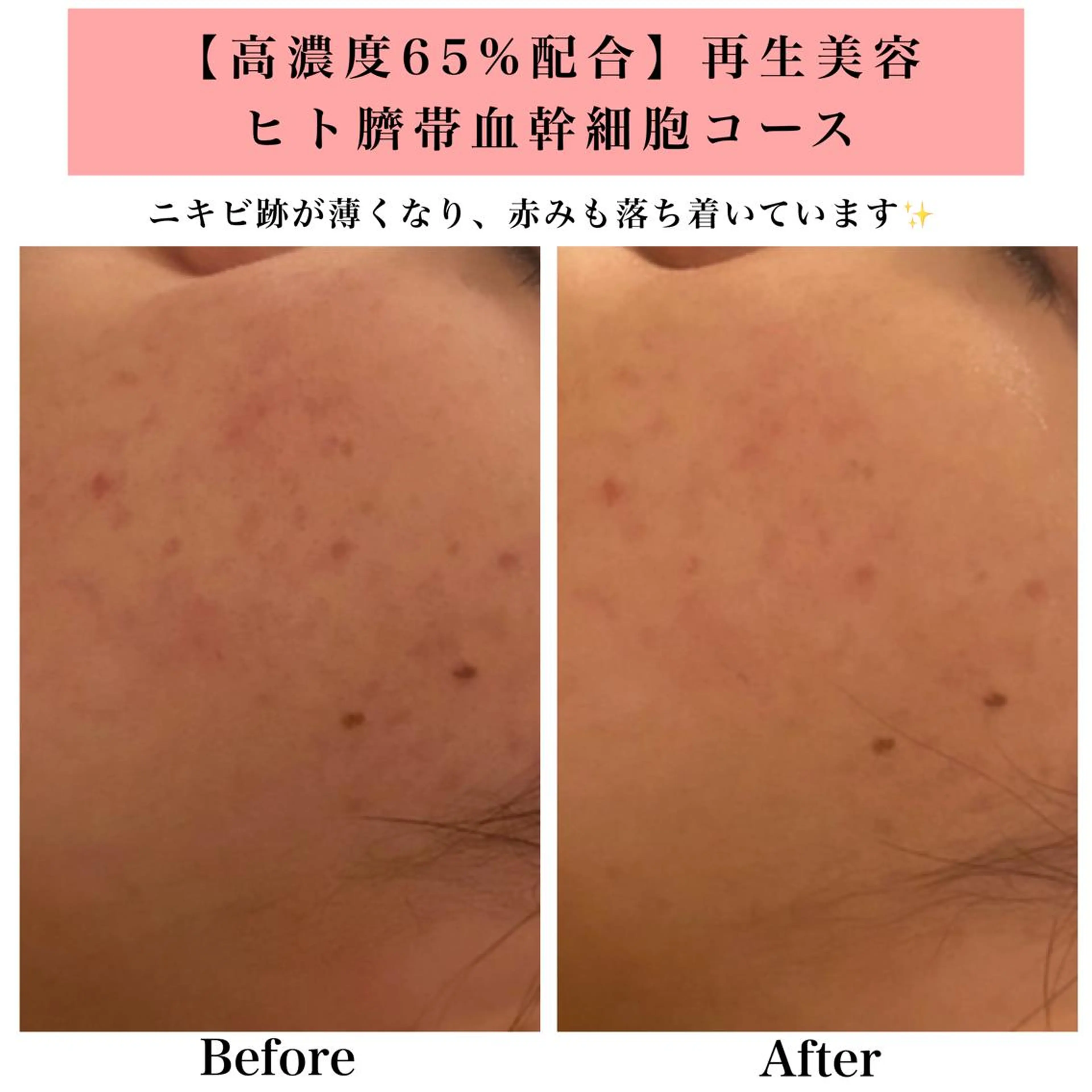 エステ リラク Bellesthe （ベルエステ）のエステ・リラクイメージ