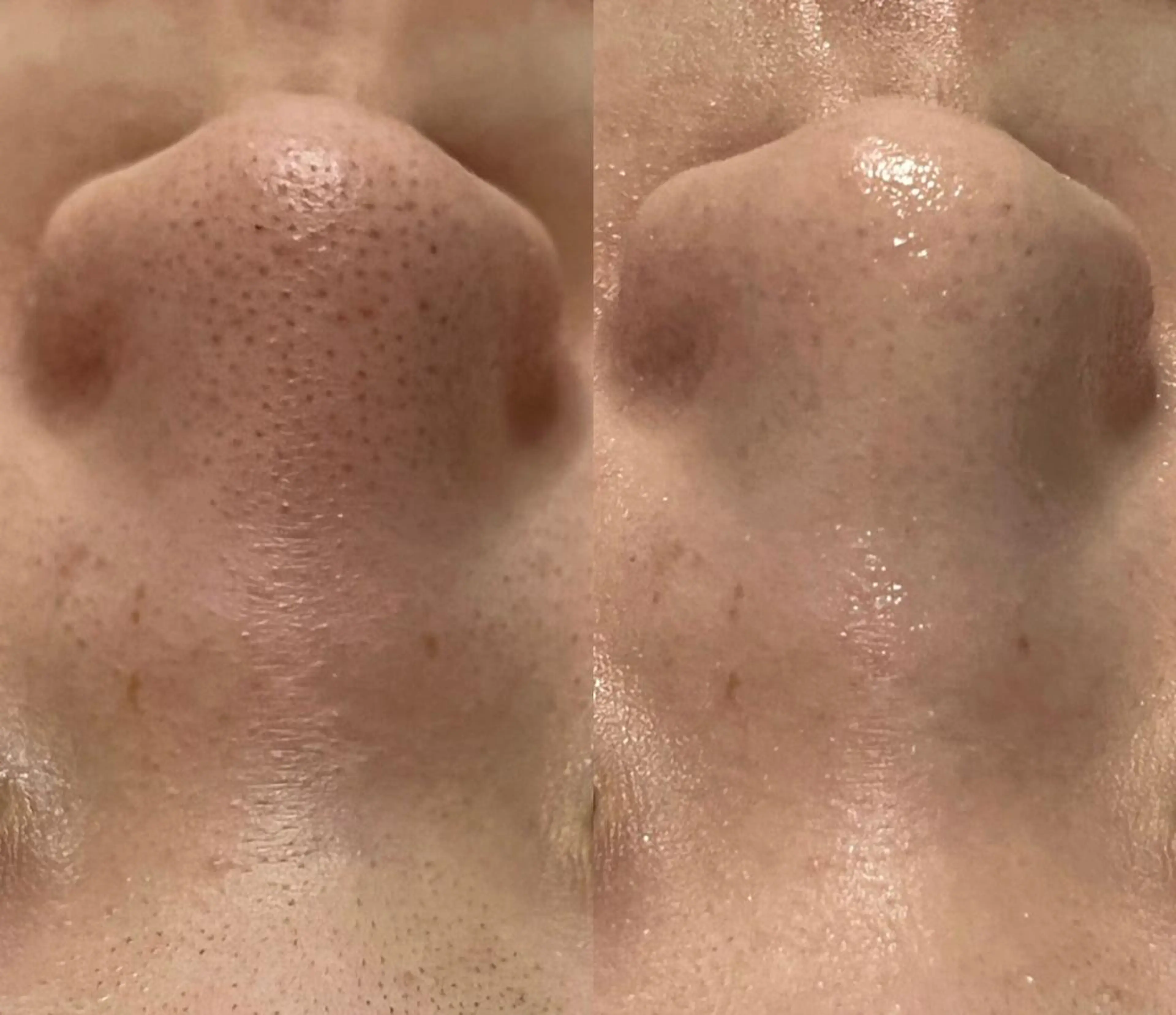 エステ BestBelleꕤ 大阪福島/肌質改善のエステ・リラクイメージ