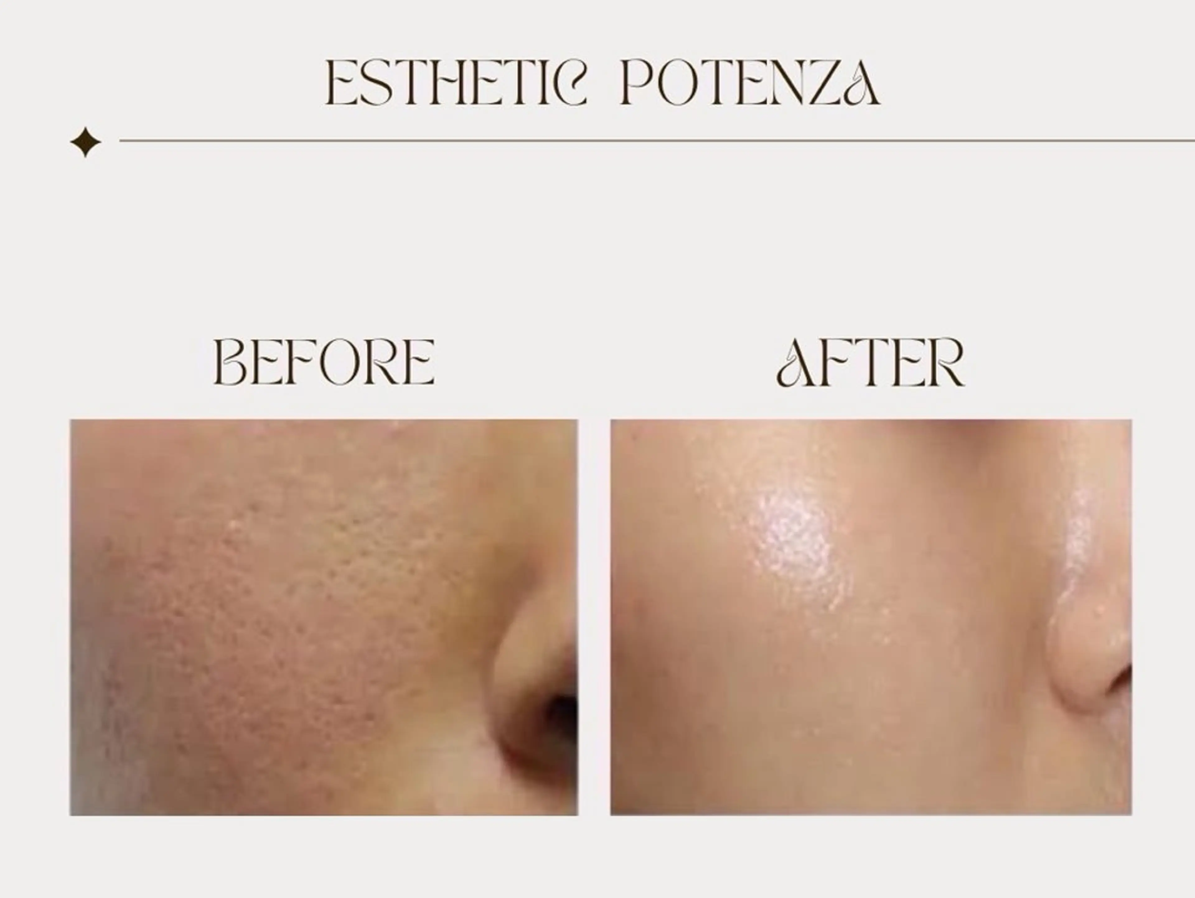 エステ 秒速小顔所属・秒速小顔 岩邊のその他イメージ