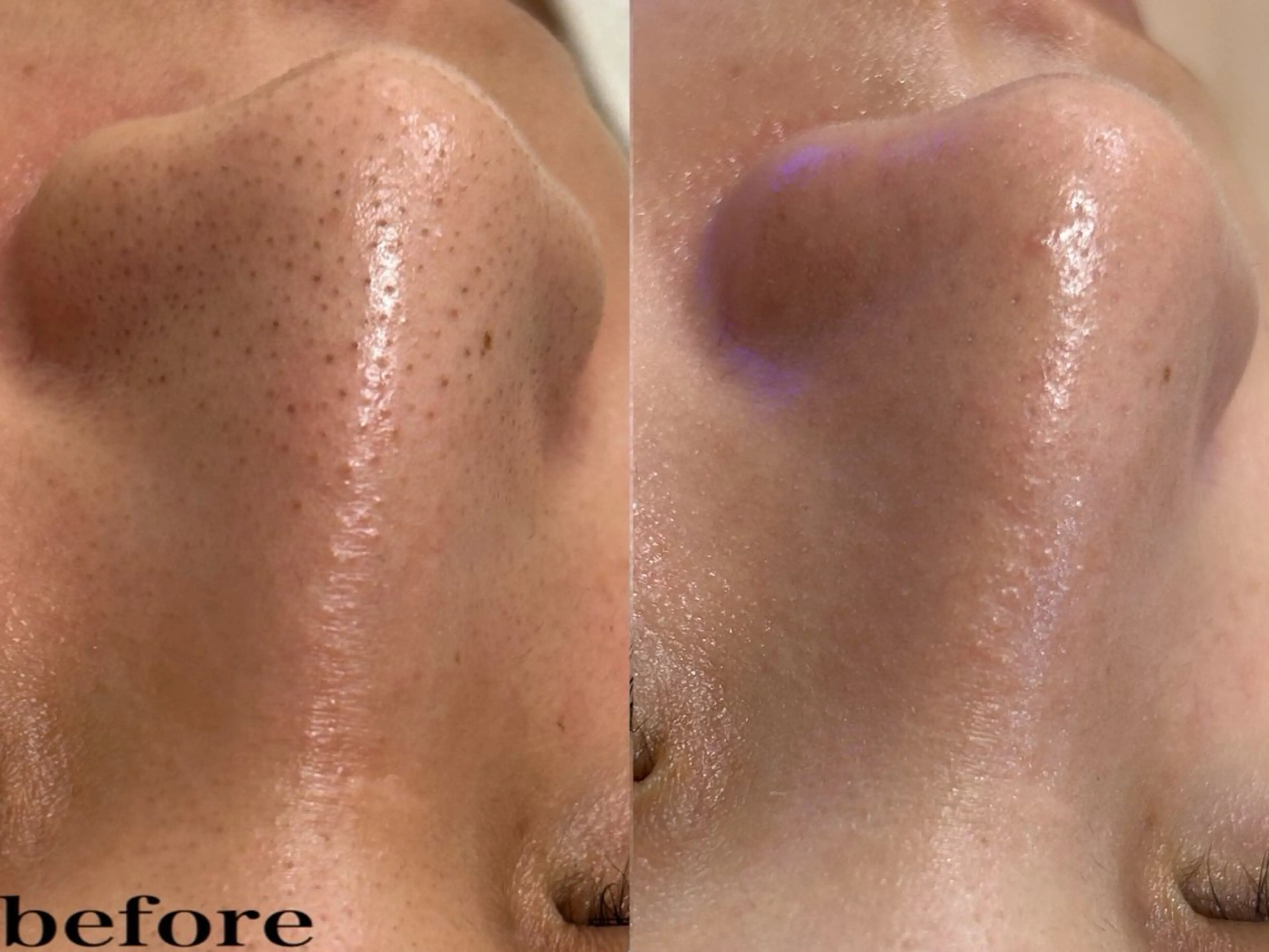 aroma  YURARI所属・韓国艶美人// 毛穴ケア🌹のエステ・リラクイメージ