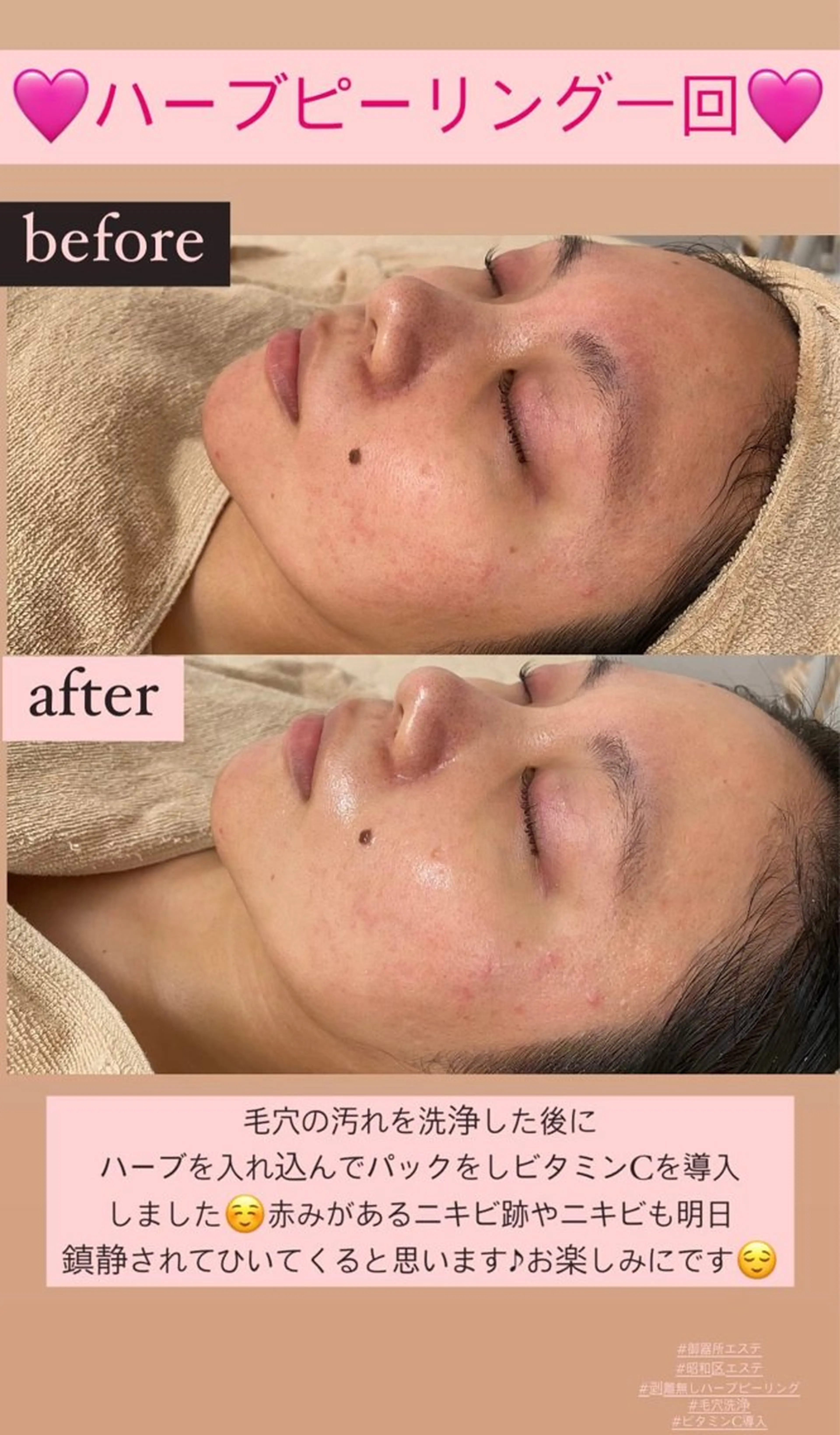 メンズ エステ Salon de Lino 御器所のエステ・リラクイメージ