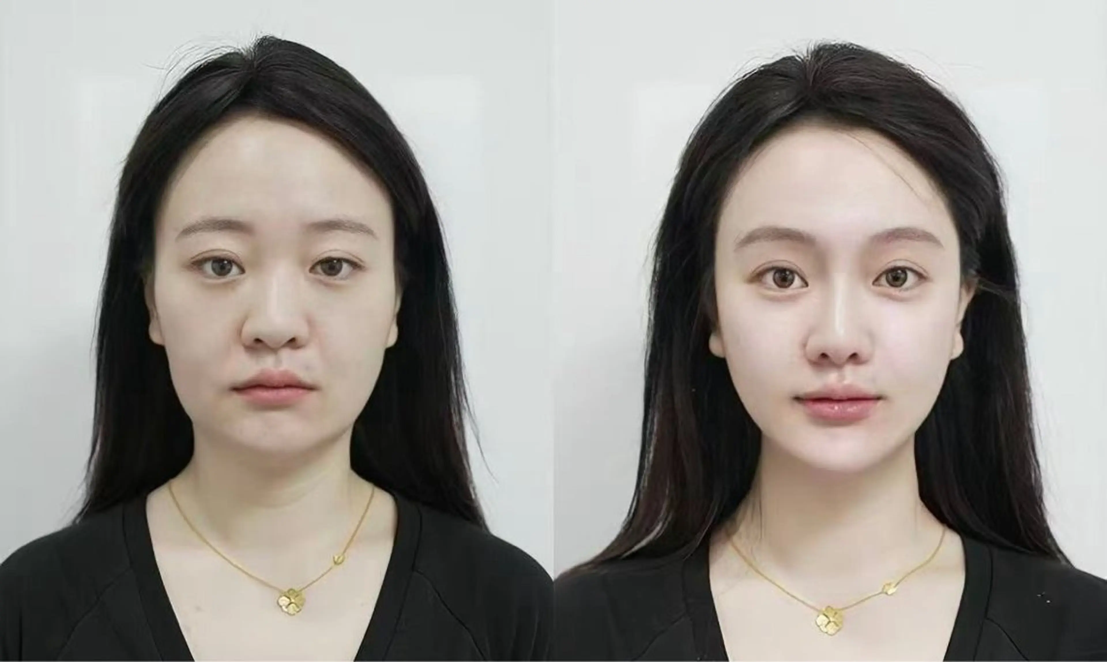 マツエク・マツパ エステ aliaハーブ水光店 エステティシャン募集のエステ・リラクイメージ