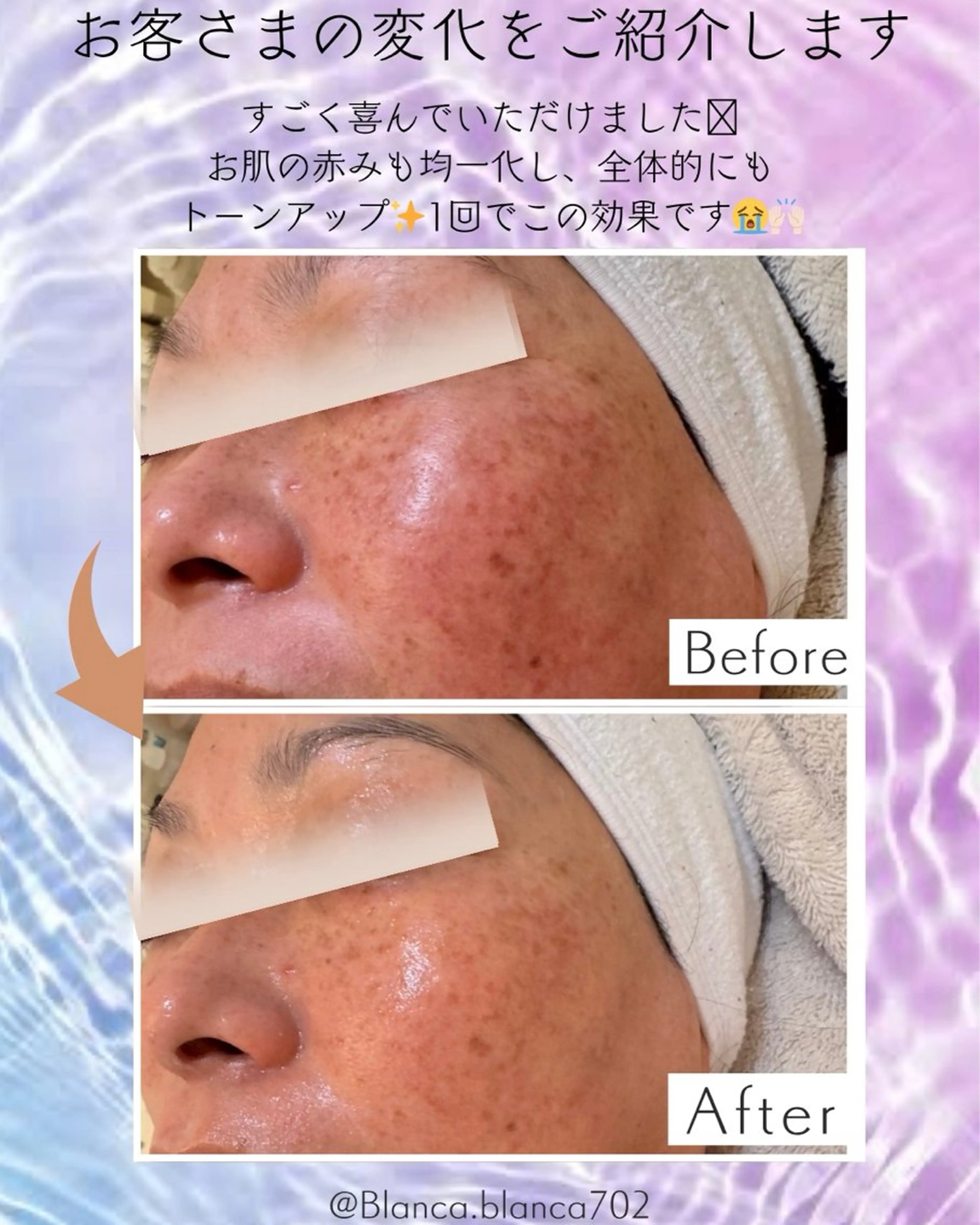 エステ プライベートエステサロンBlanca所属・Blanca ナミキのエステ・リラクイメージ