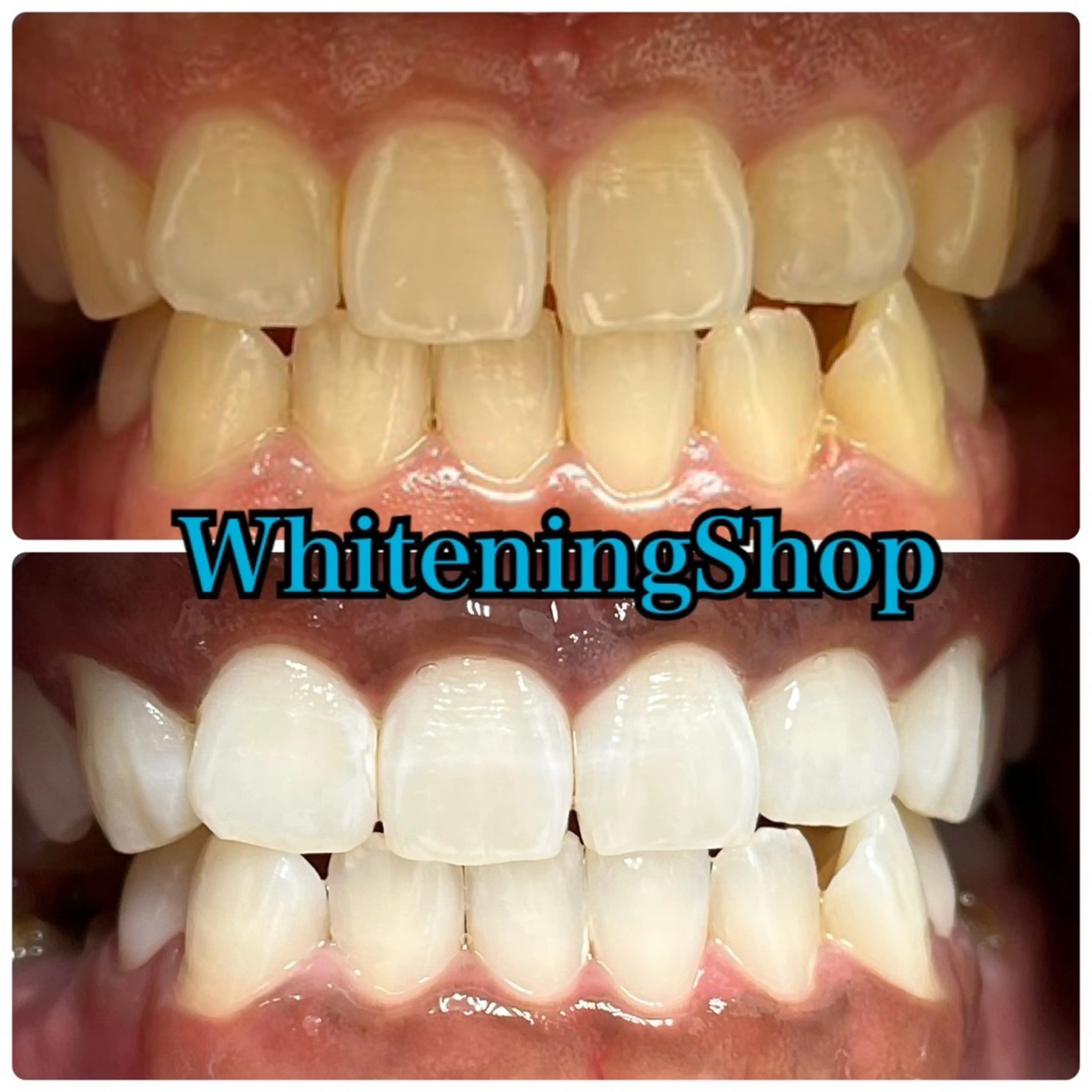 エステ リラク ホワイトニング ショップ吉祥寺店のエステ・リラクイメージ