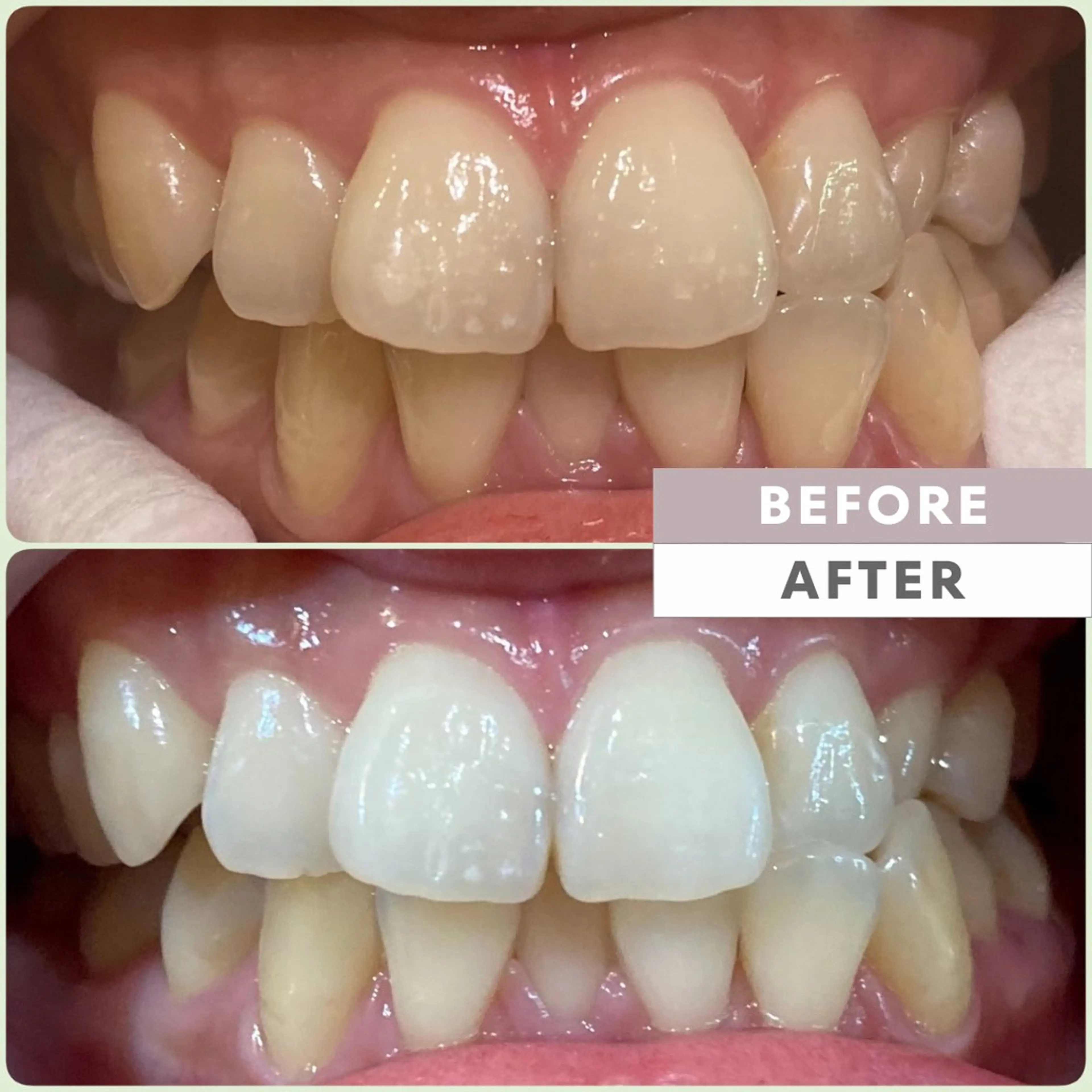 イージー ホワイト ニング 新宿店のエステ・リラクイメージ