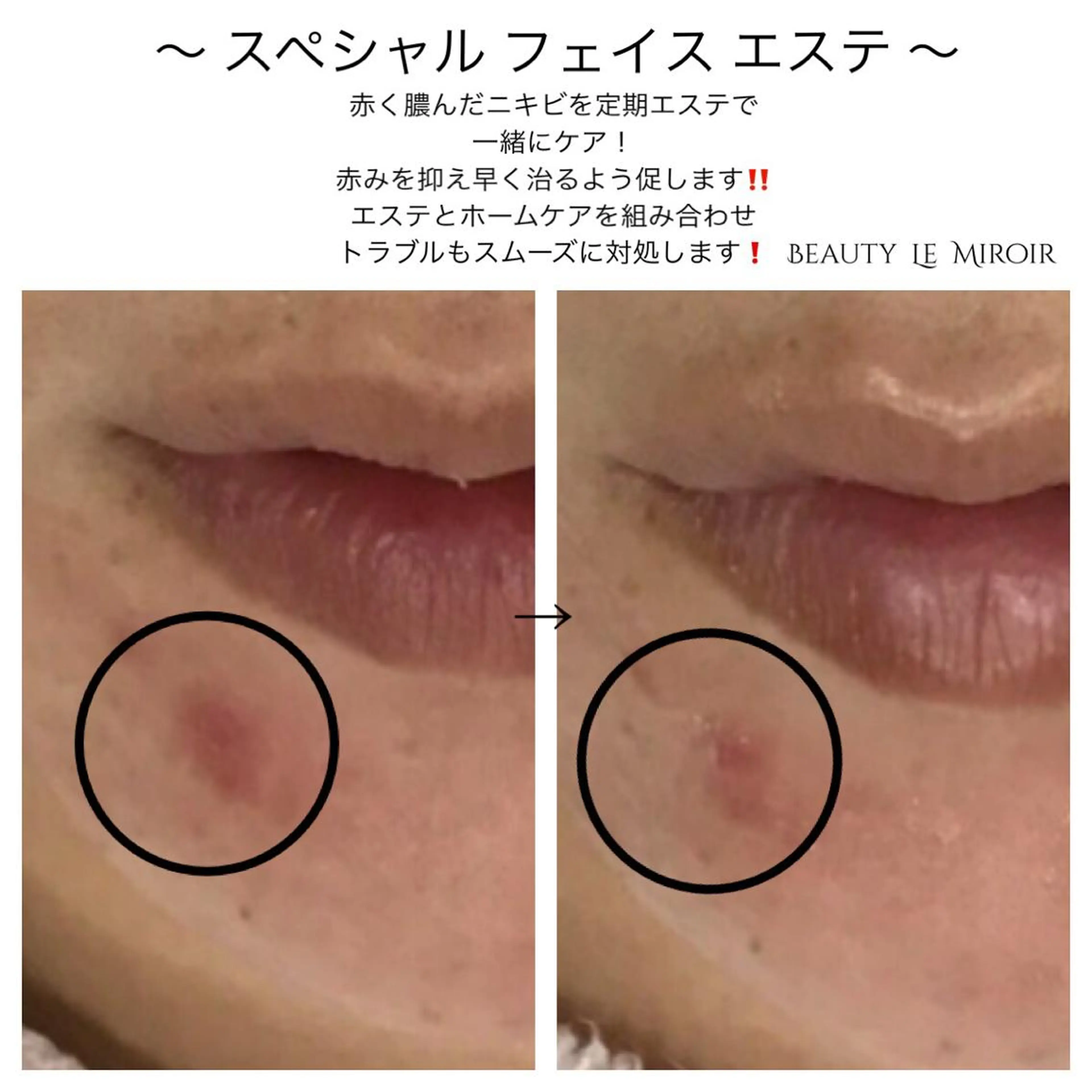 ビューティー ミロワールのエステ・リラクイメージ