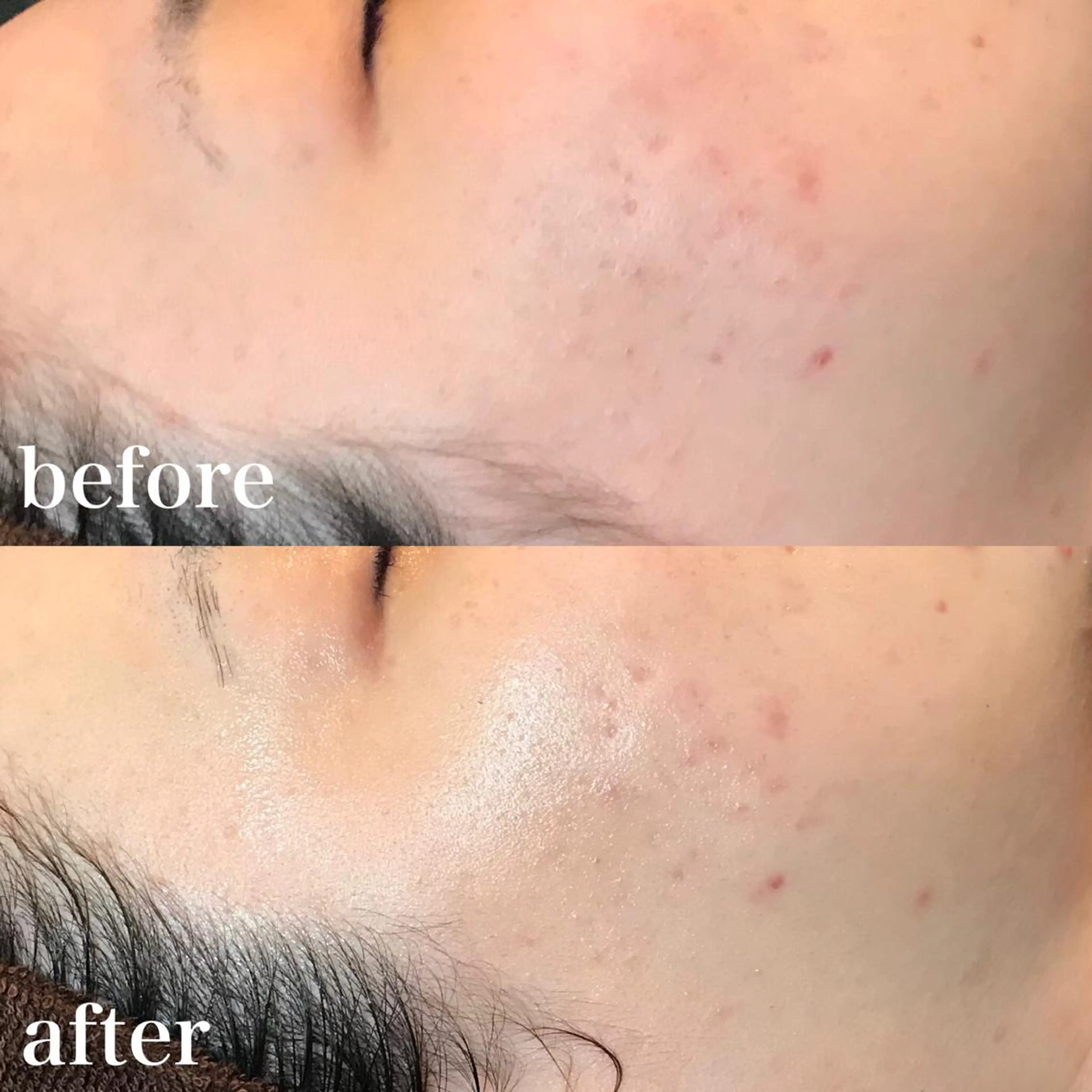 エステ 浜野 恵美のエステ・リラクイメージ