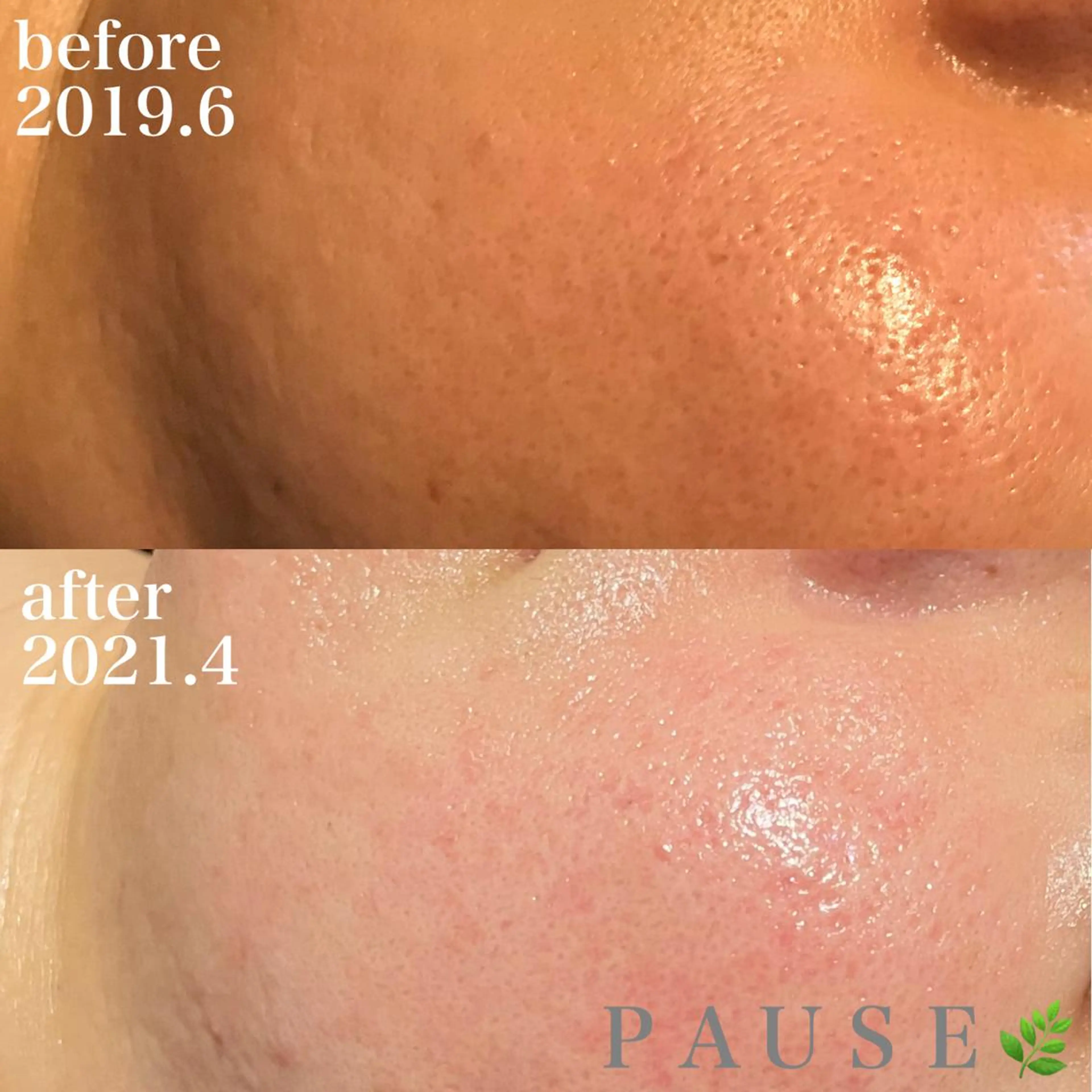 エステ 浜野 恵美のエステ・リラクイメージ