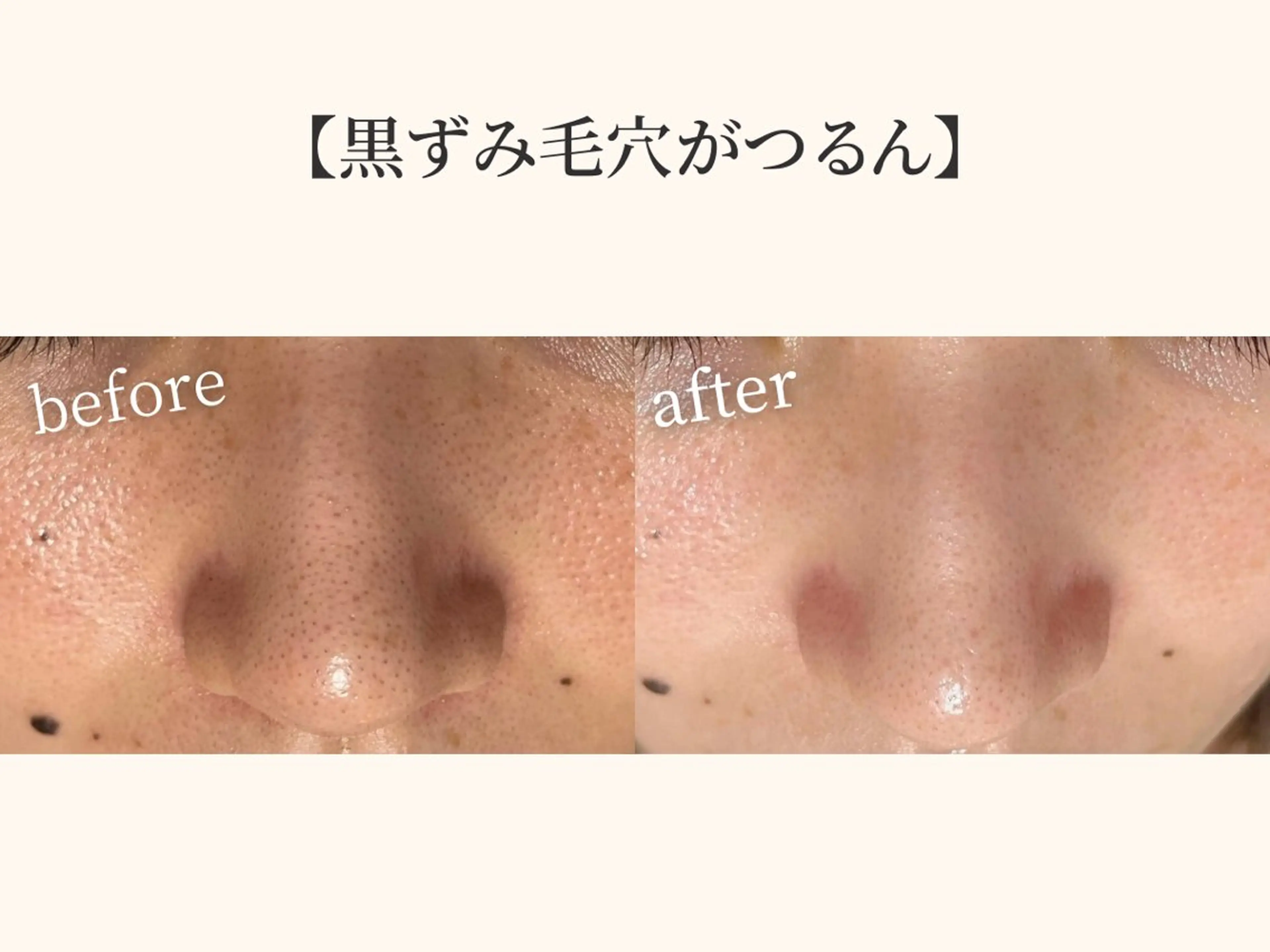 小顔矯正×毛穴サロン DRRAMSPA町田のエステ・リラクイメージ