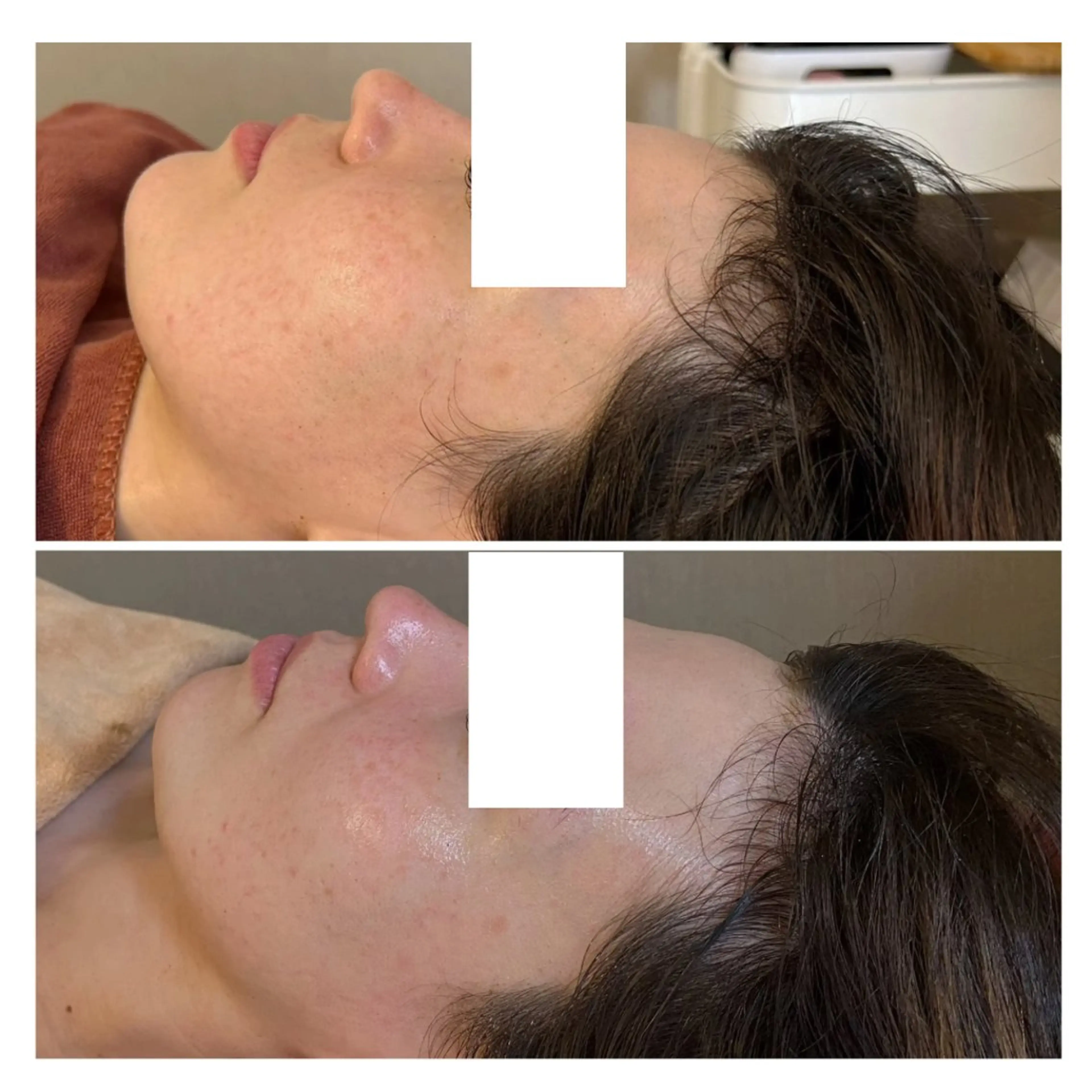 エステ 肌質改善ワックス専門 yukiのエステ・リラクイメージ