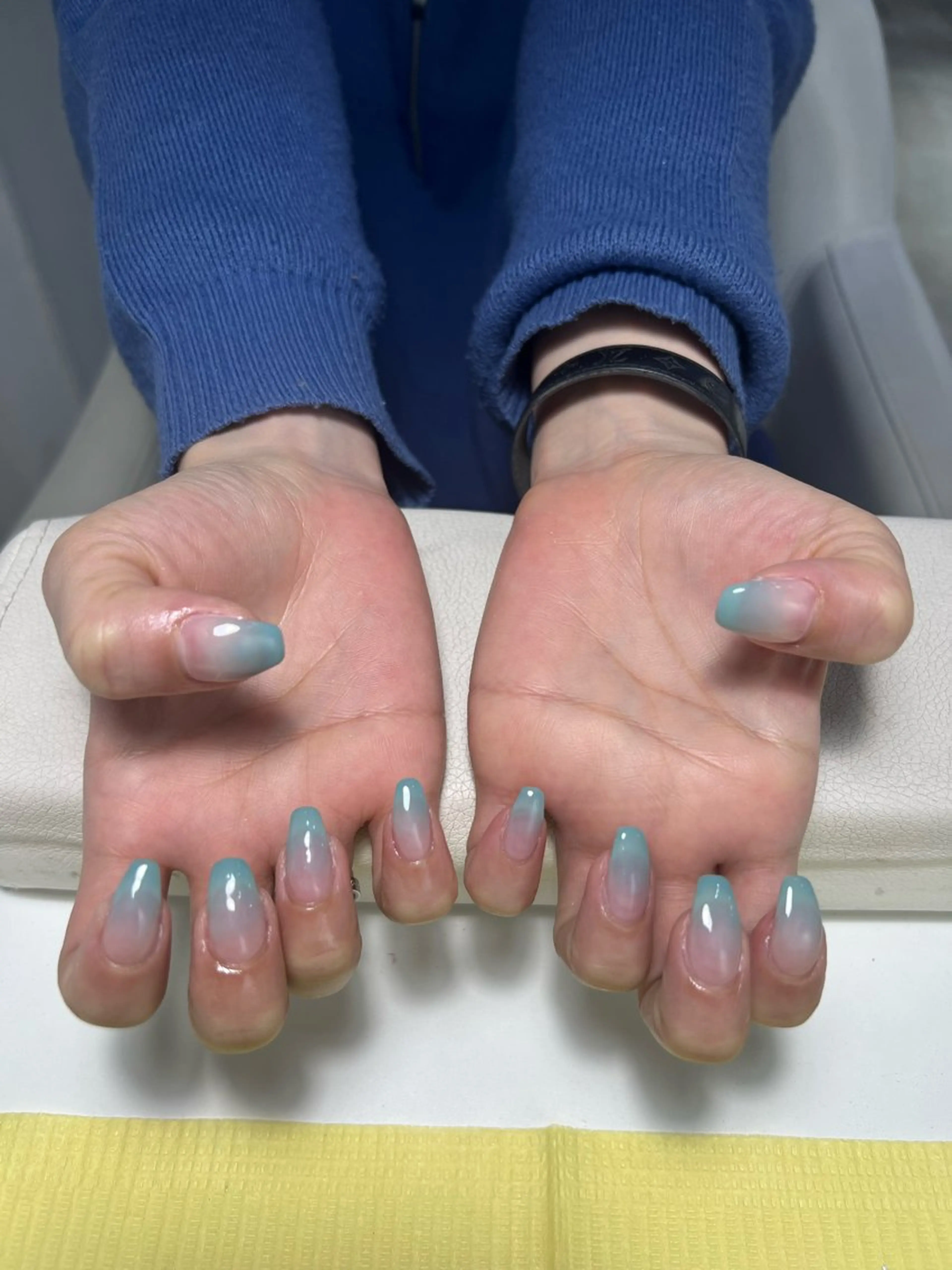 🐯カラグラ　オフ込み🧡 フィルイン施術の写真