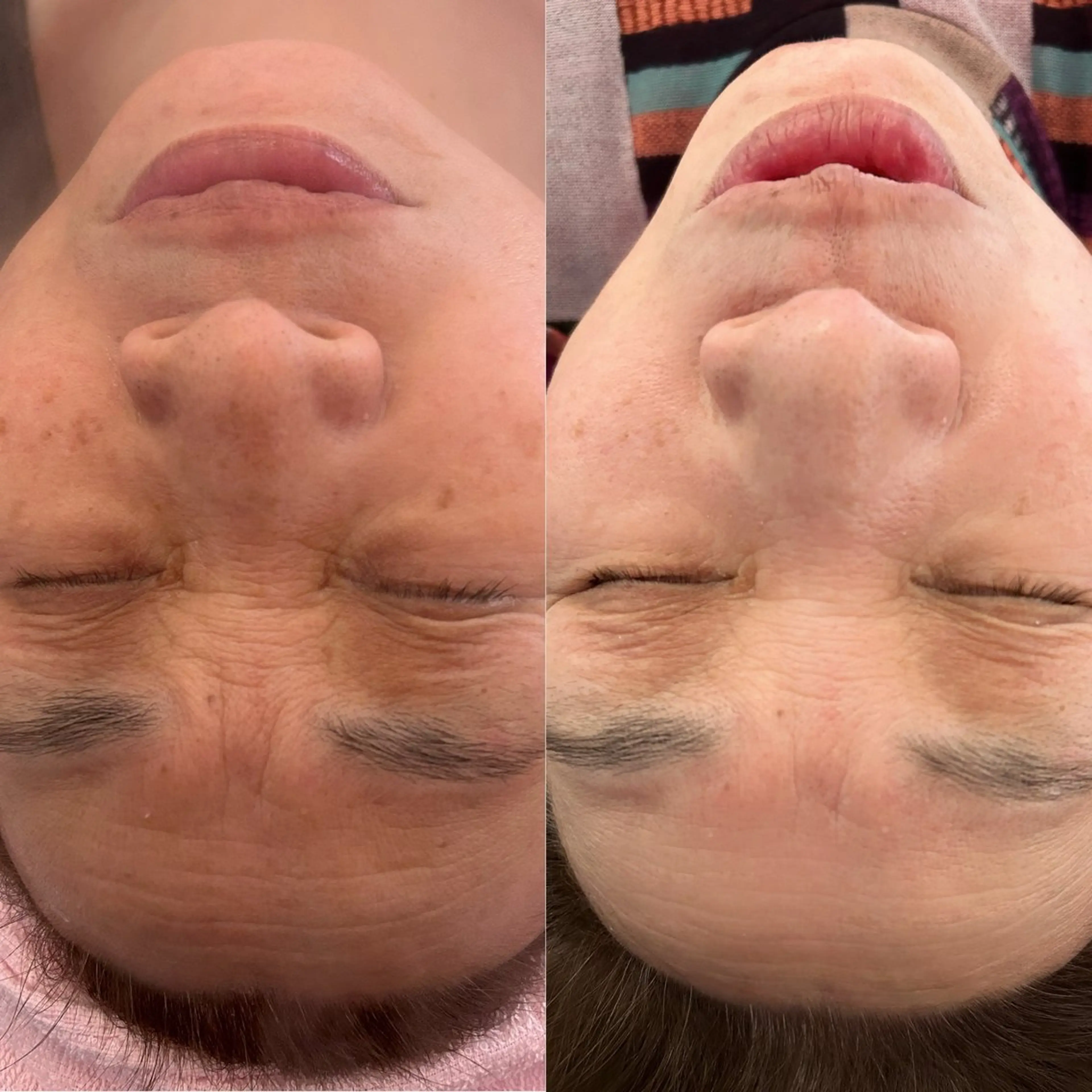 ラ・デエース✨ 肌質改善　中里のエステ・リラクイメージ