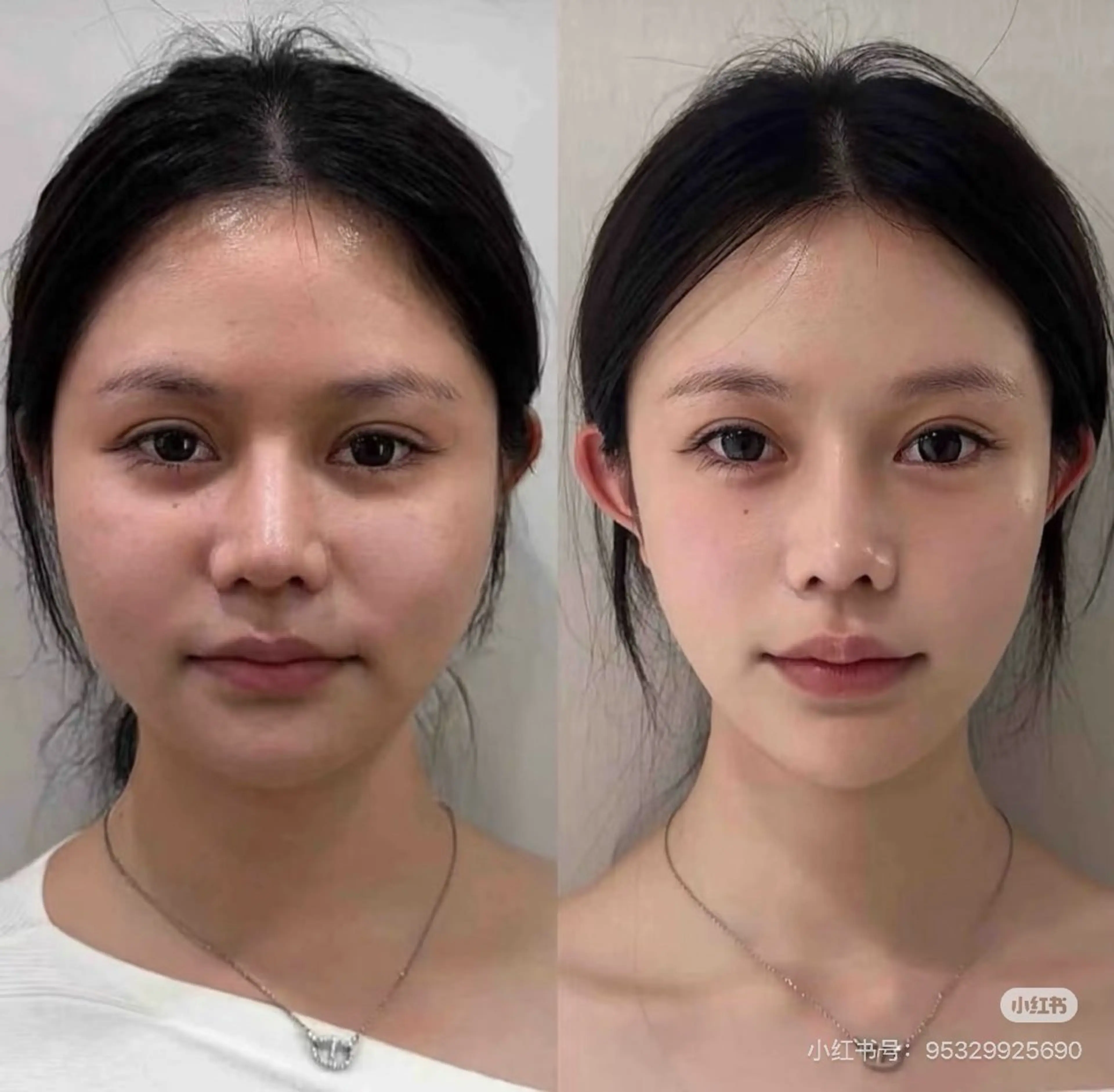 マツエク・マツパ エステ aliaハイフ&水光ジェットサロン所属・aliaハーブ水光店 エステティシャン募集のエステ・リラクイメージ