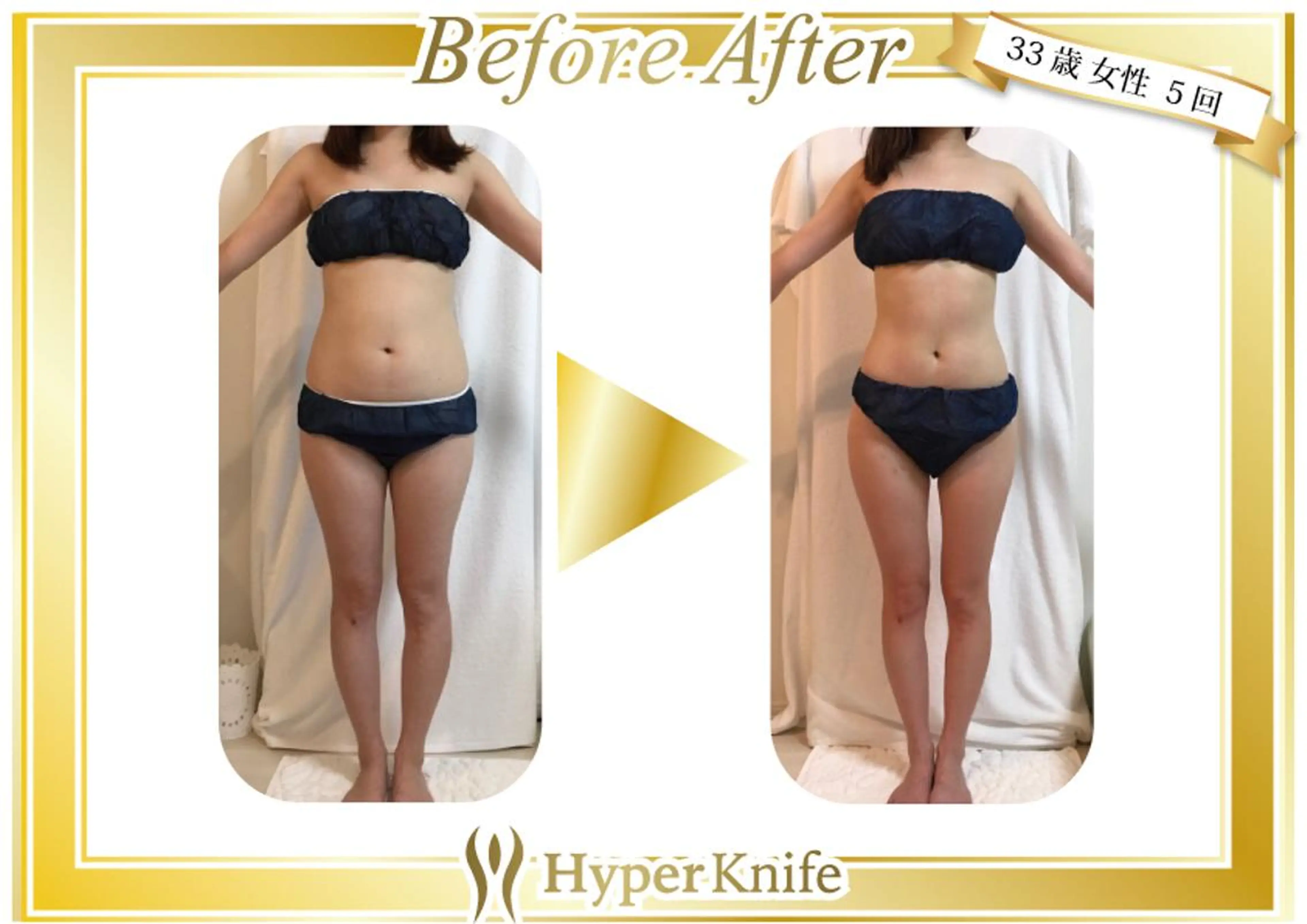 ネイルサロン　フローラ所属・渡邉 とし子のマツエク・マツパデザイン