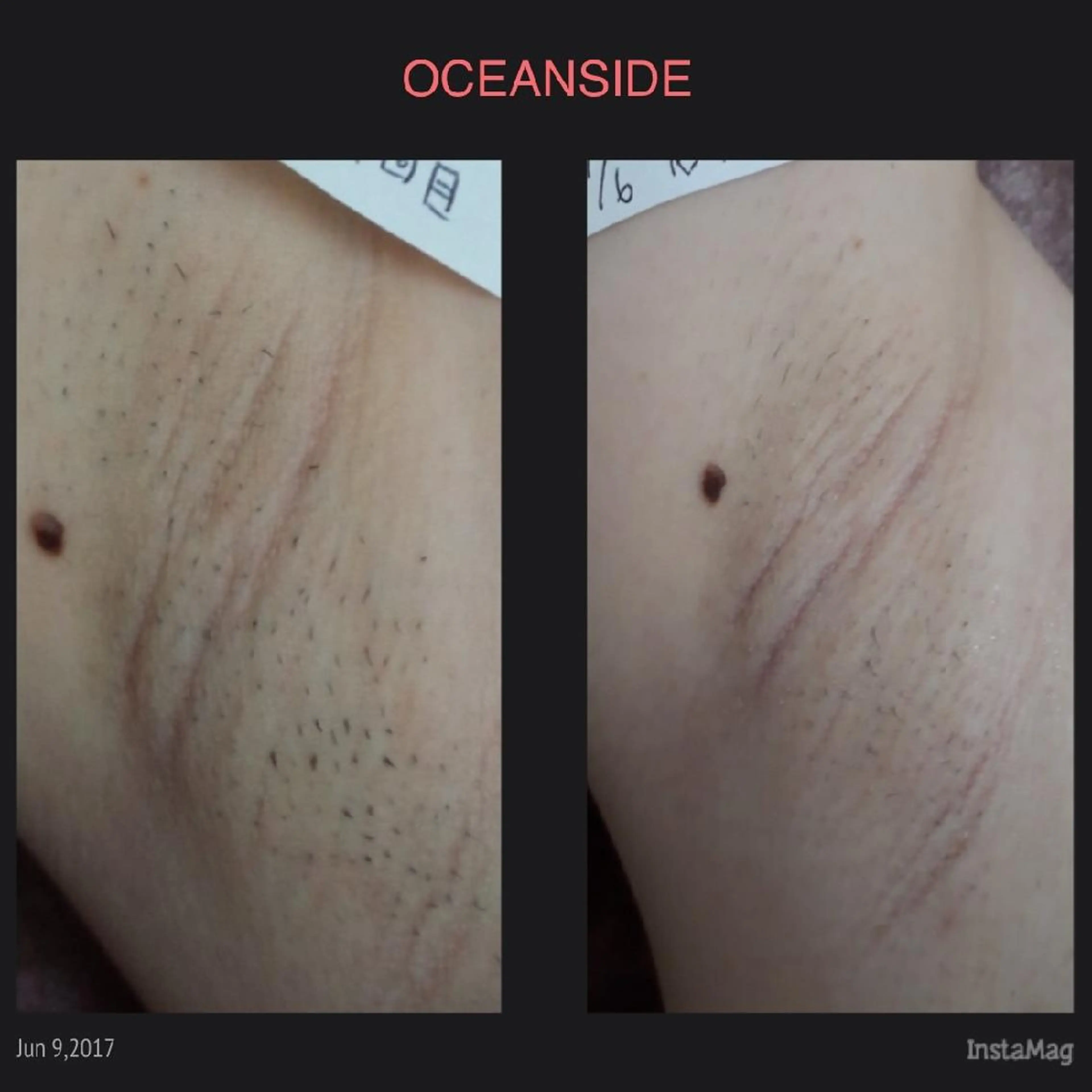 Prima（プリマ） 名古屋駅本店のエステ・リラクイメージ