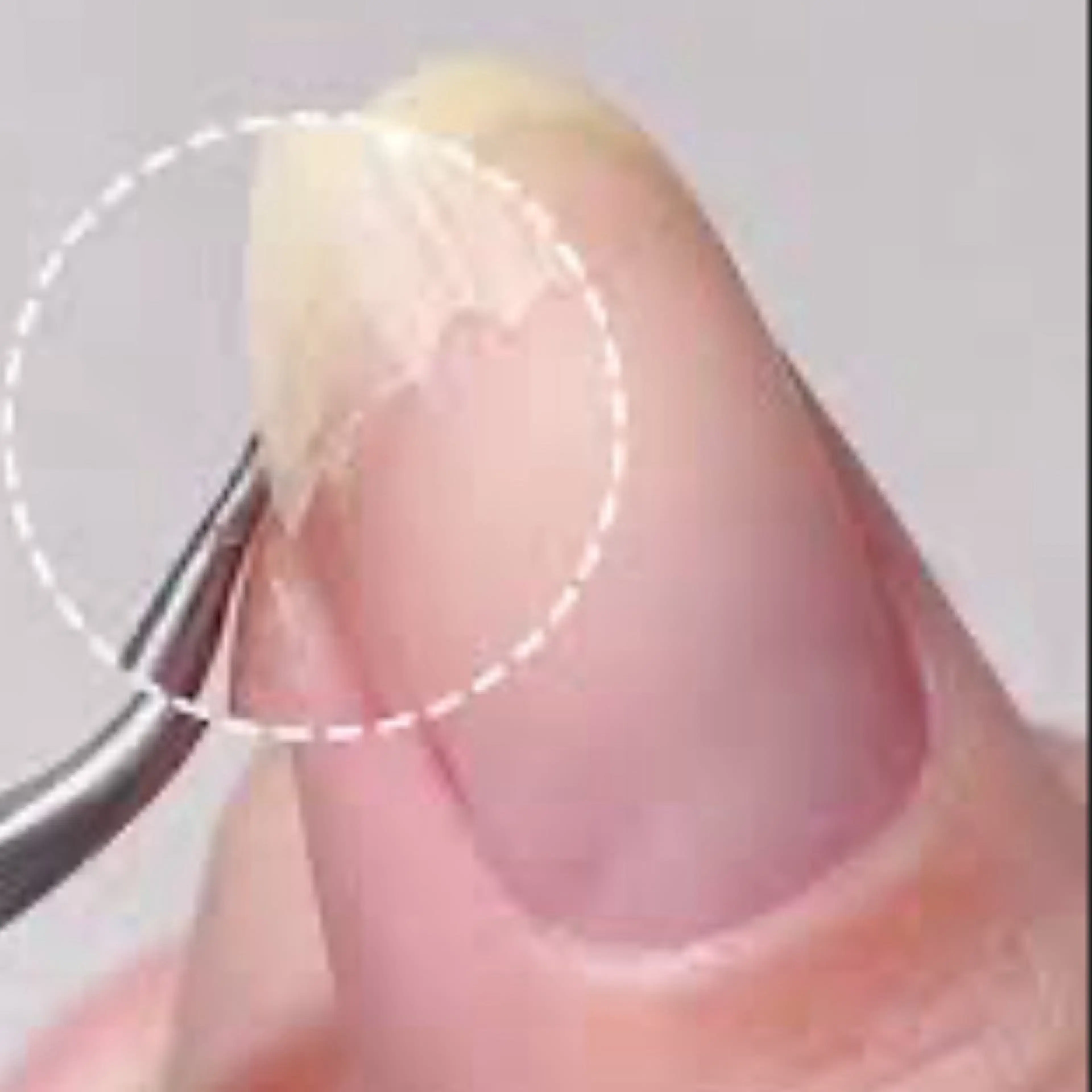 亀裂補強（本数を予めお知らせ下さい）の写真