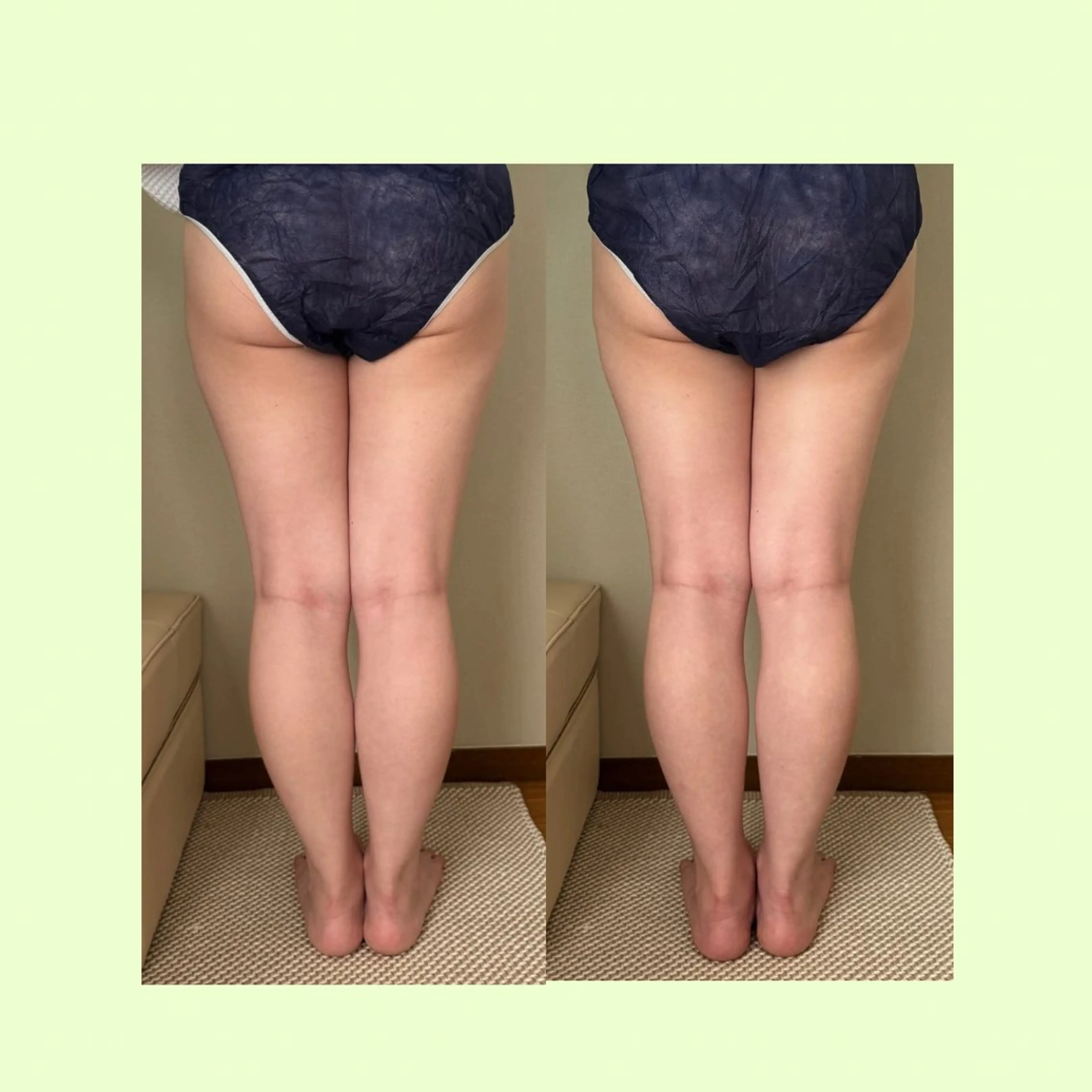 リラクゼーションスパ　ひのき所属・spaHINOKI 【女性専用】のエステ・リラクイメージ