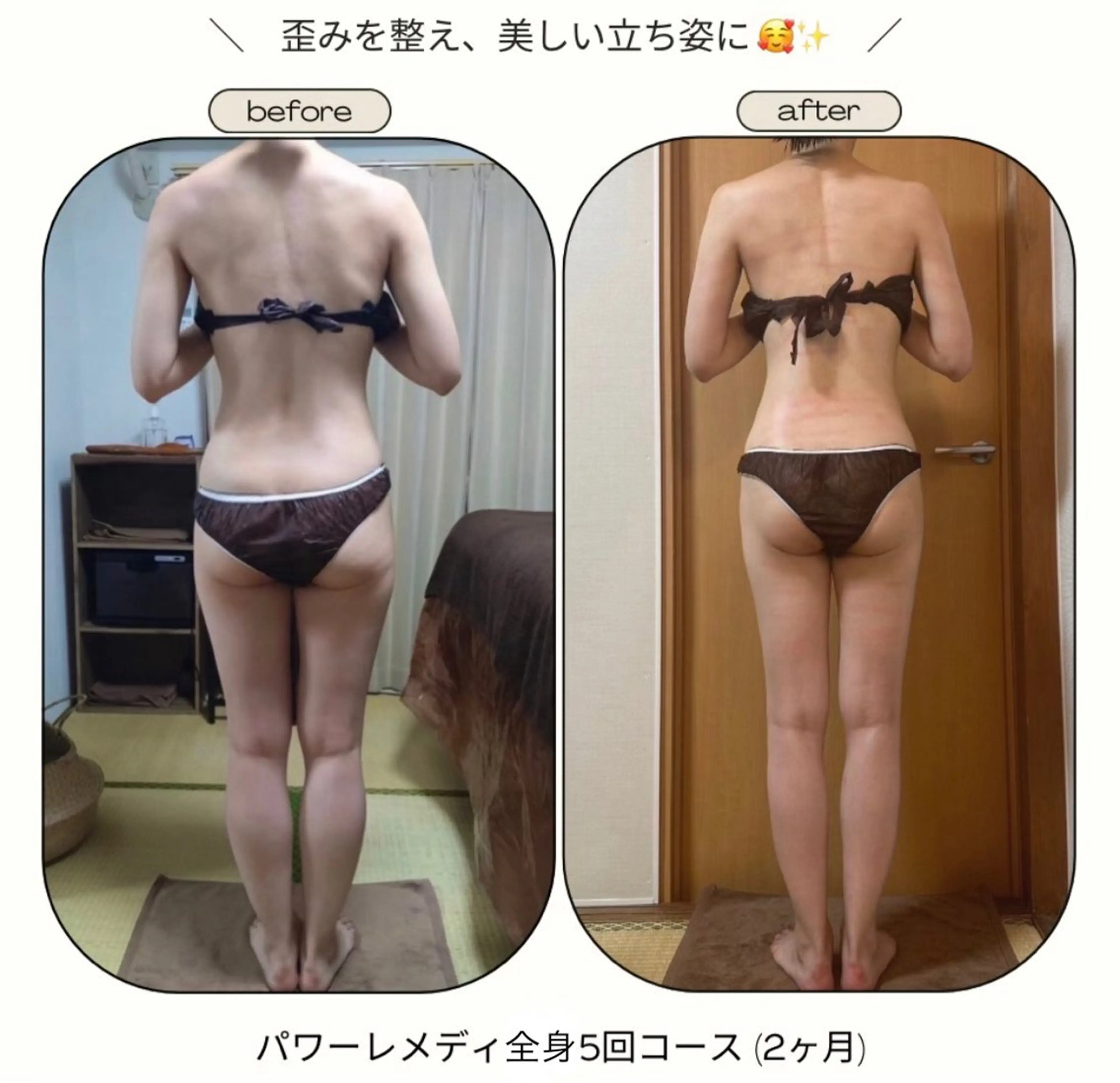 《本気痩せ×疲労改善 》  BILOOPのエステ・リラクイメージ