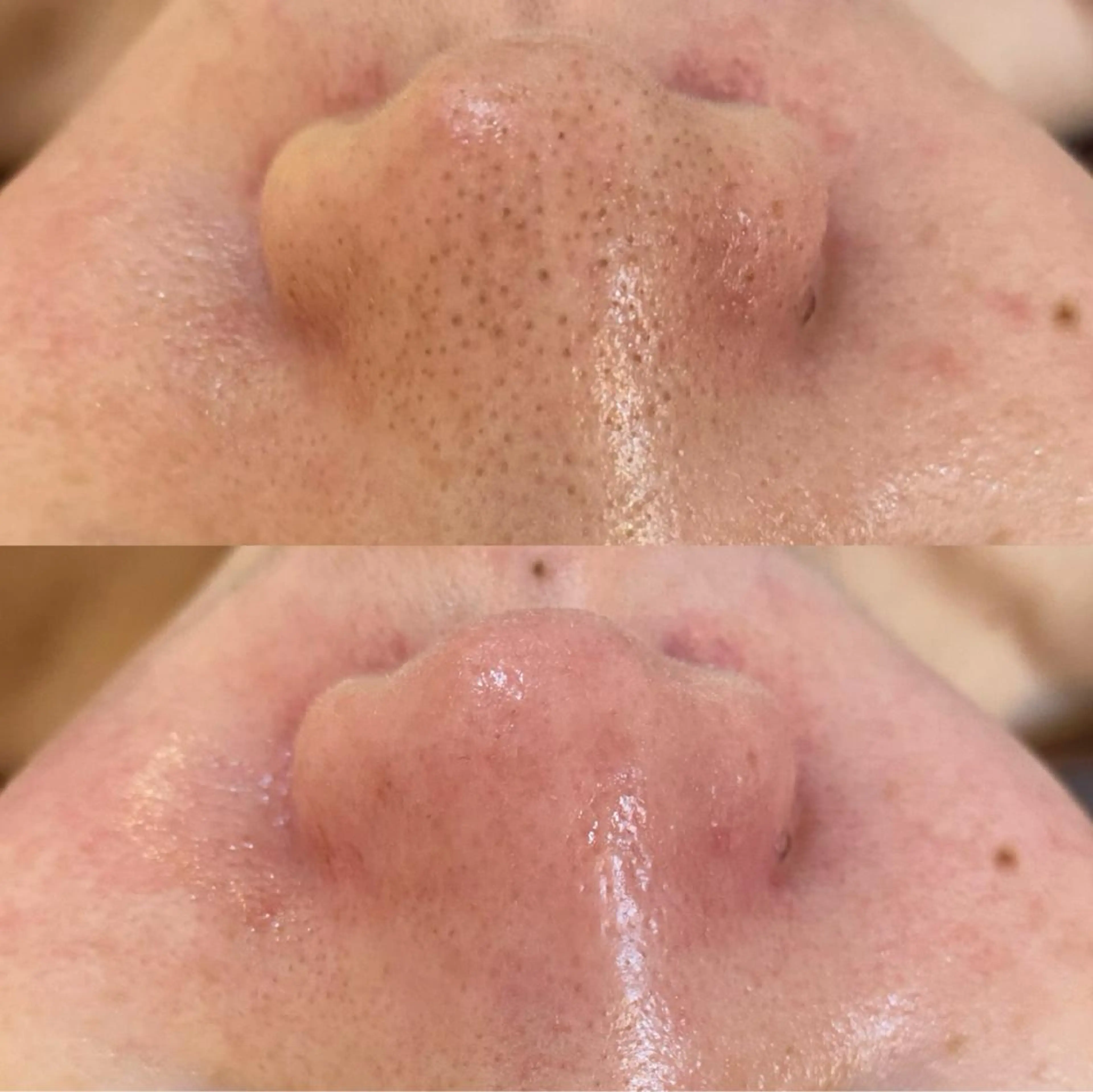 エステ リラク BELCIA福岡店 レコルトデベルシアのエステ・リラクイメージ