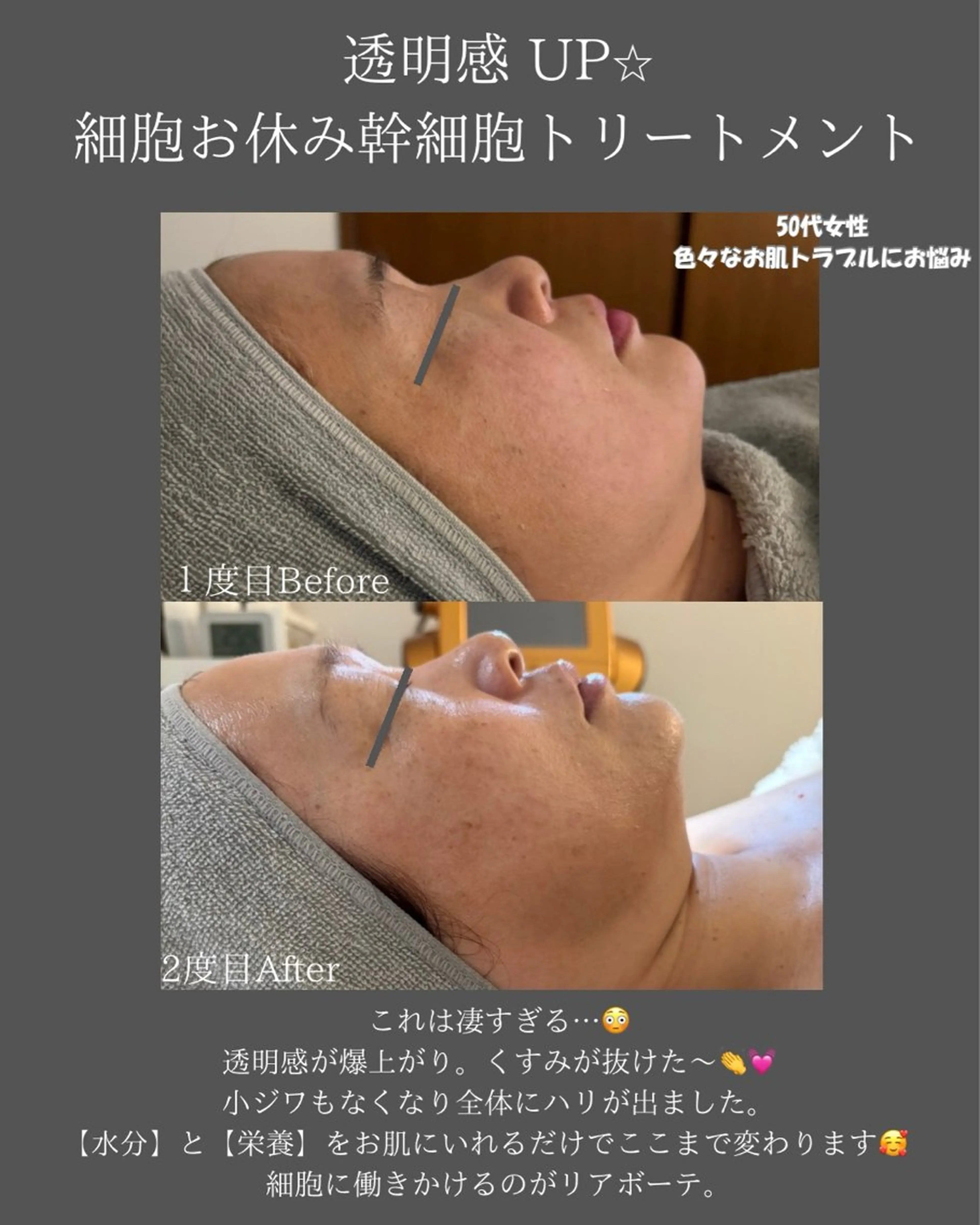 BLOSSOM 菊地のエステ・リラクイメージ