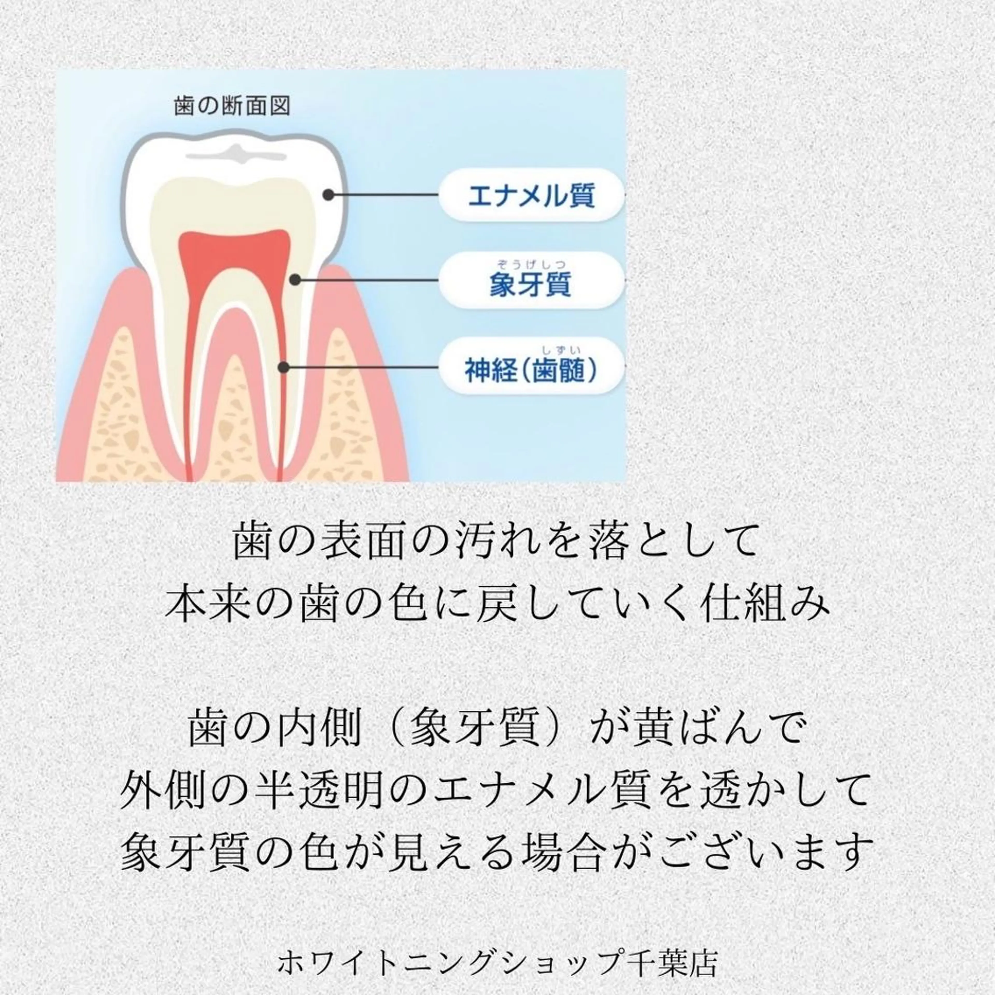 メンズ その他 ホワイトニング ショップ千葉店のその他イメージ