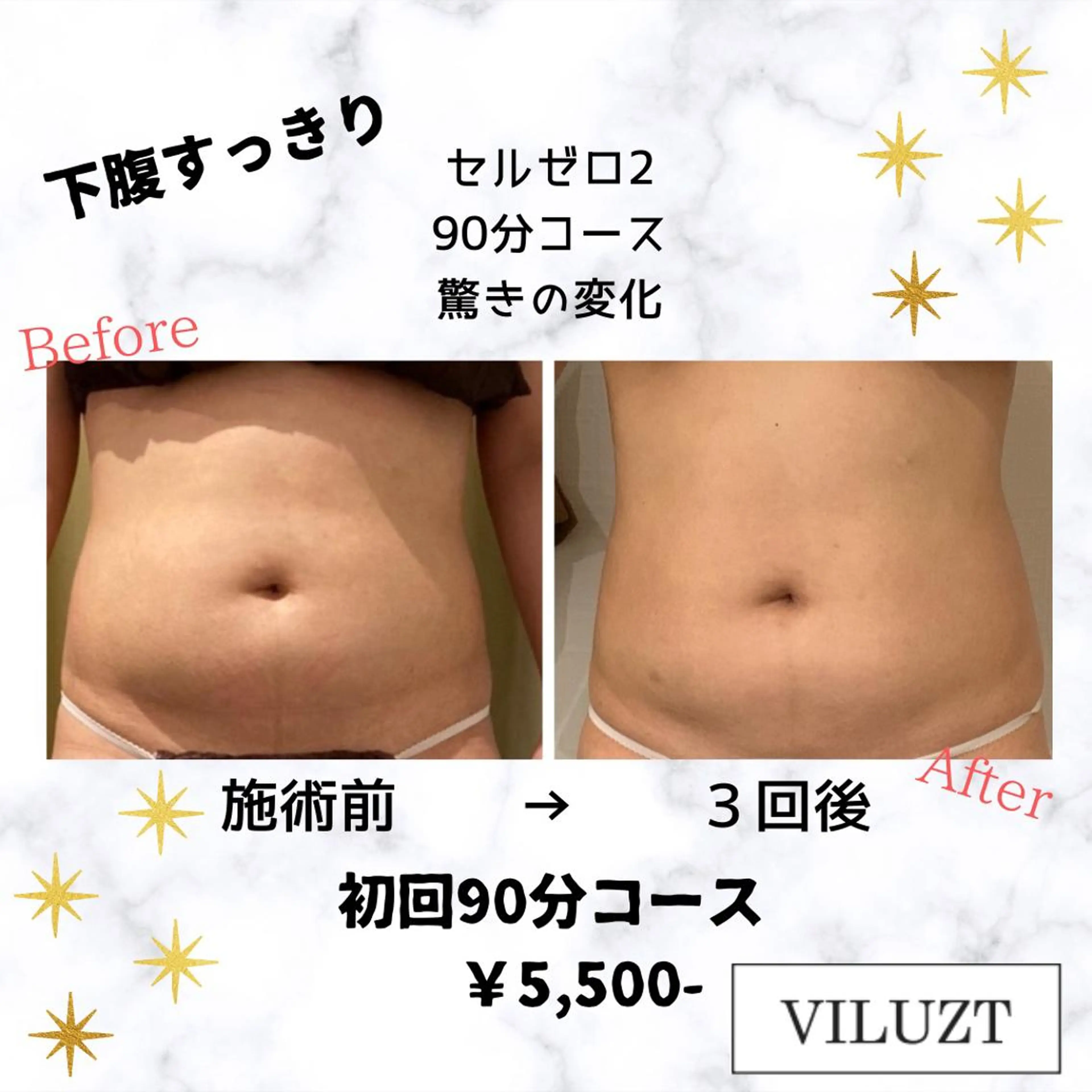 VILUZT スタッフのエステ・リラクイメージ