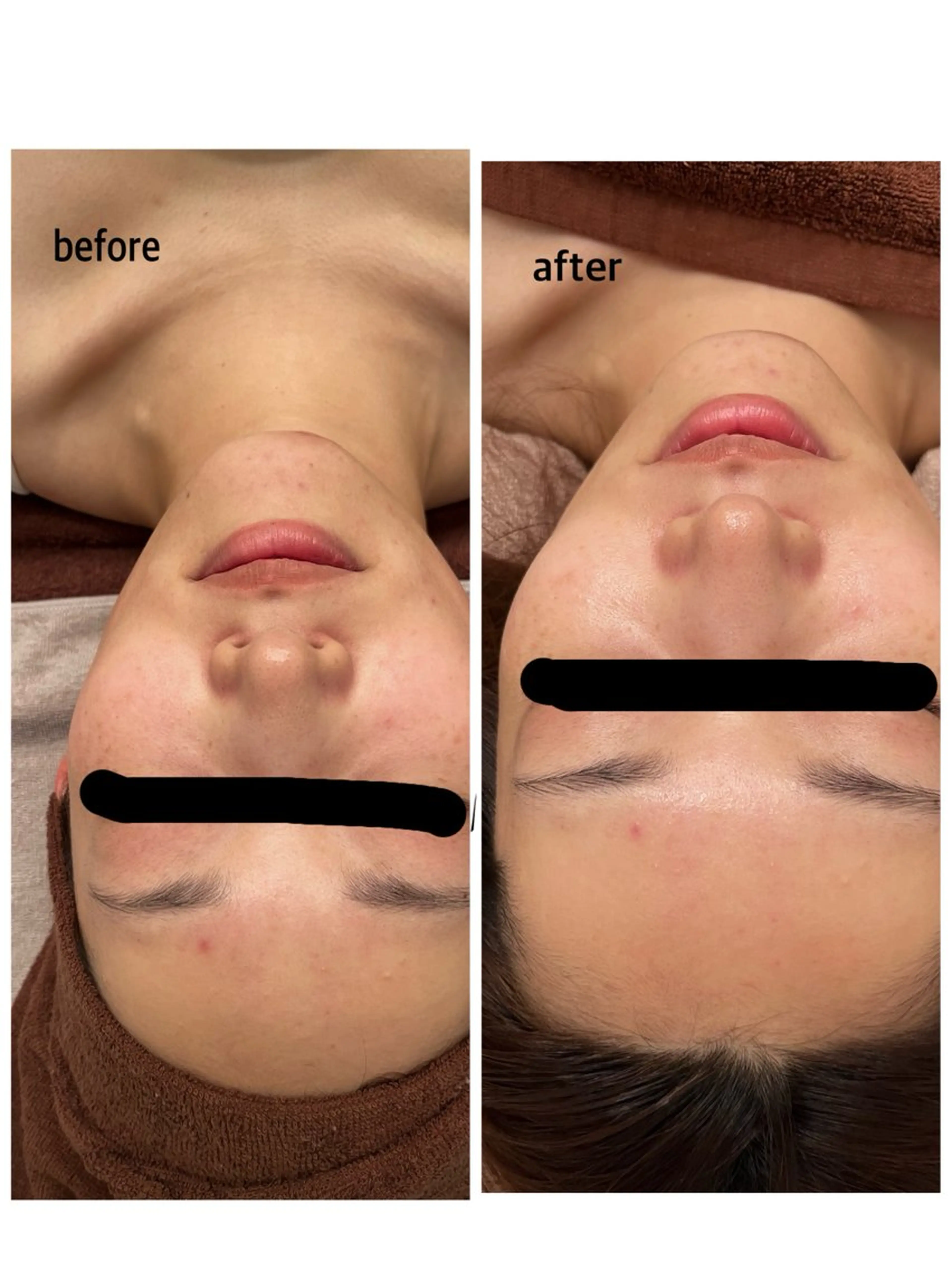 その他 mignonne ミニョンヌのエステ・リラクイメージ